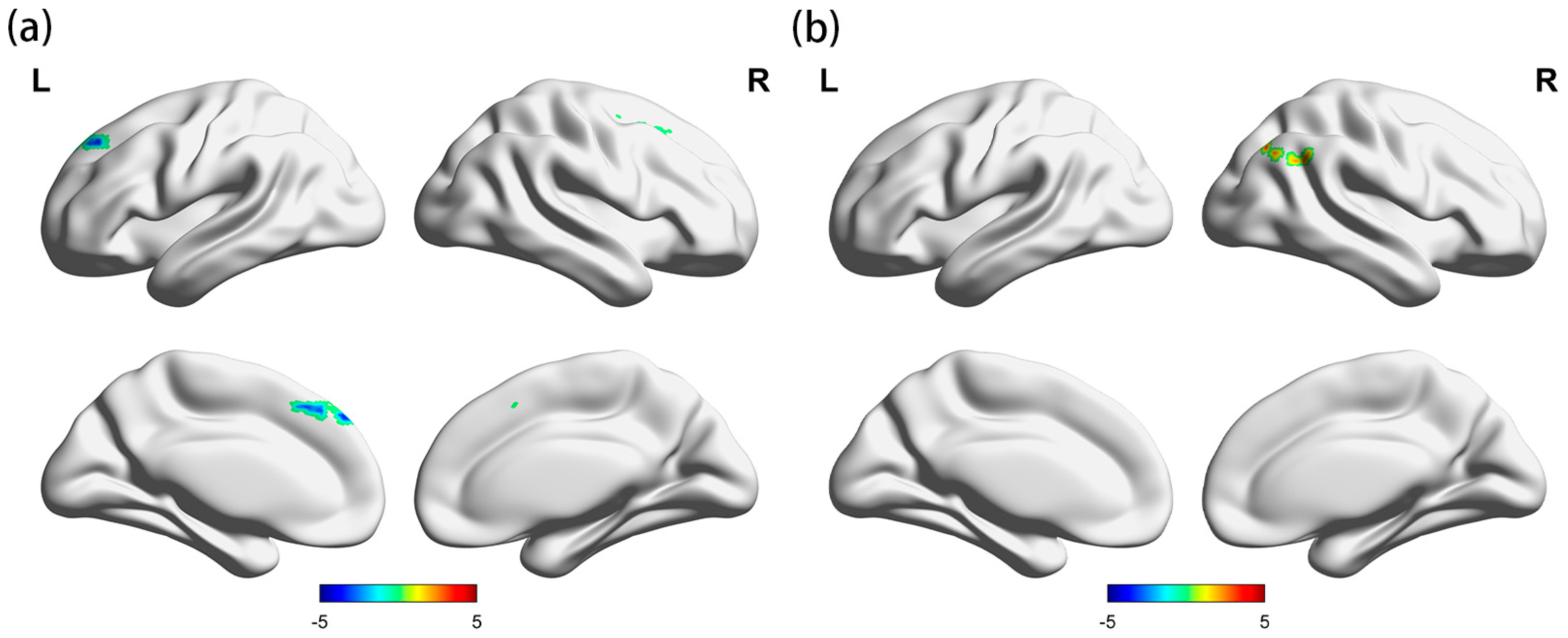 Brainsci 13 01508 g004