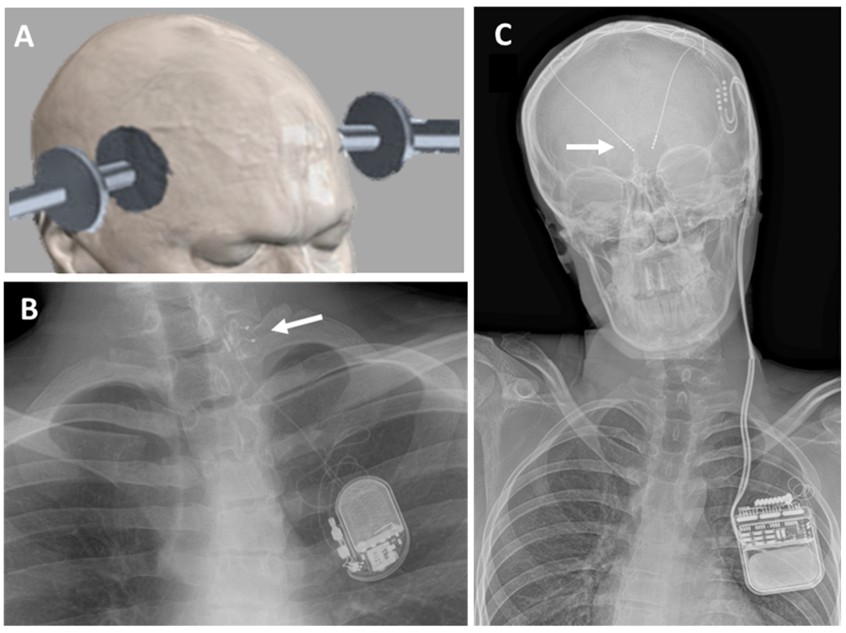 Brainsci 13 01527 g001