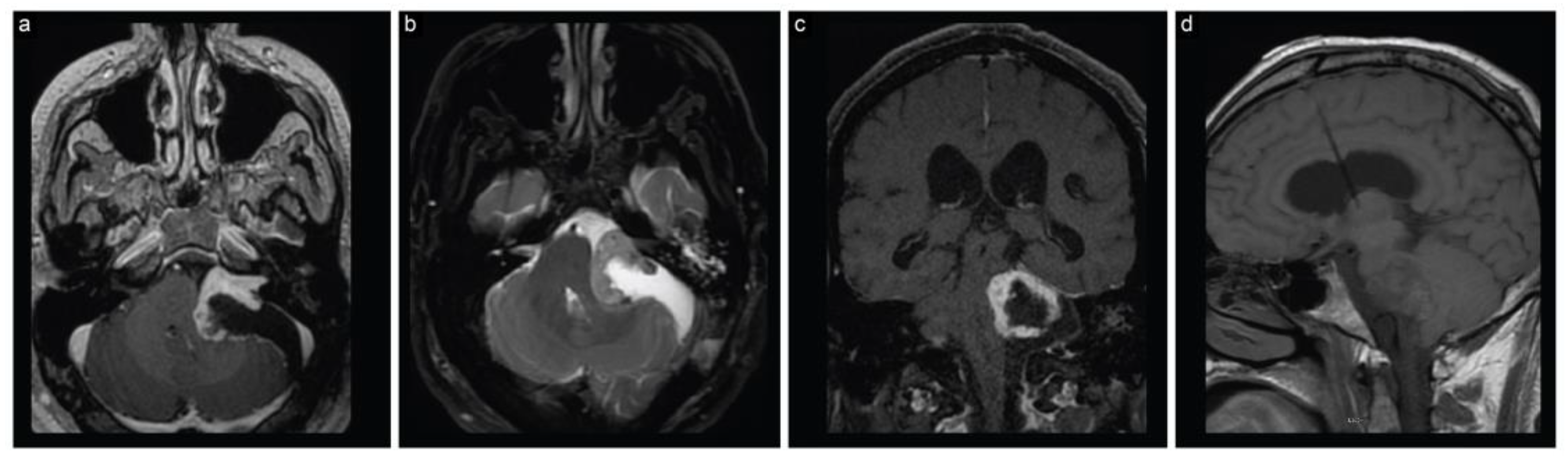 Brainsci 13 01548 g002 Brainsci 13 01548 g002