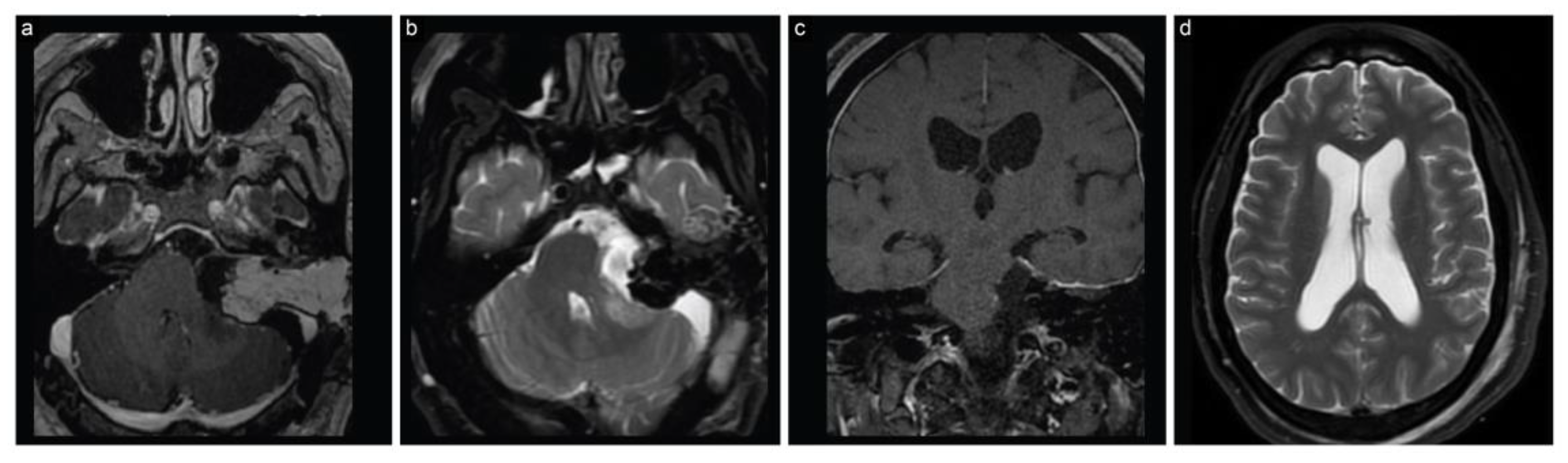 Brainsci 13 01548 g003 Brainsci 13 01548 g003