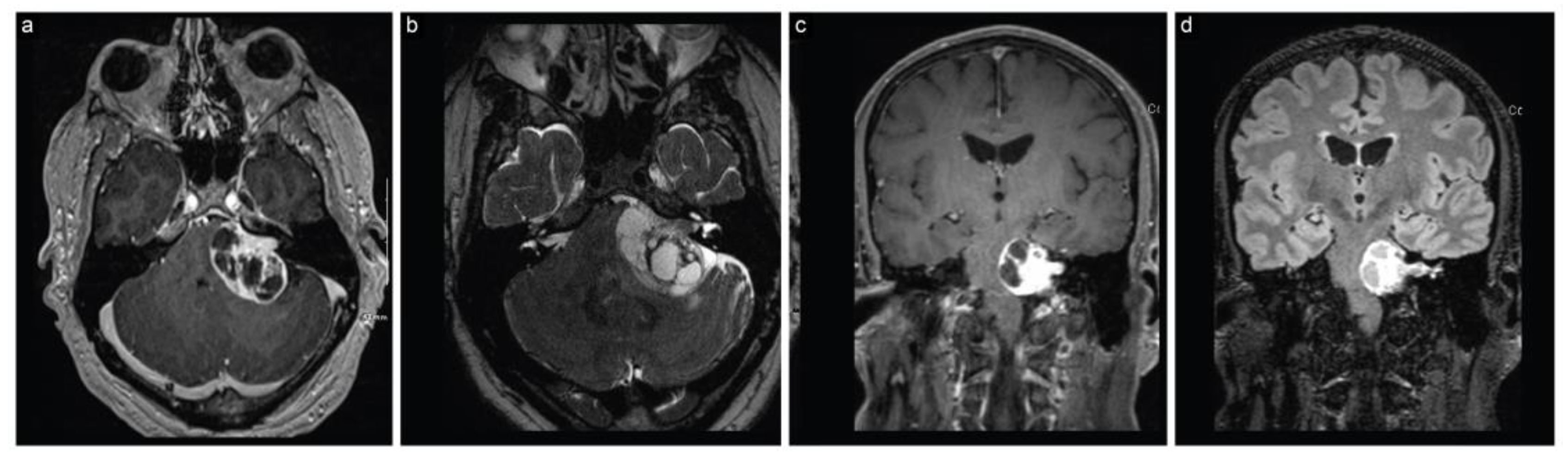 Brainsci 13 01548 g004 Brainsci 13 01548 g004