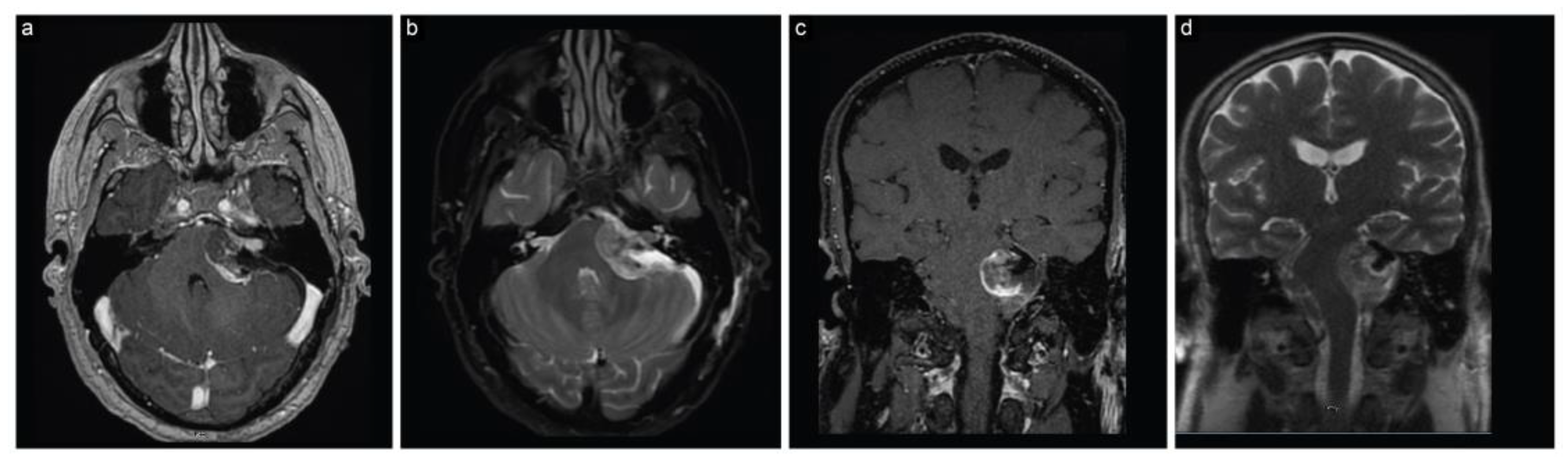 Brainsci 13 01548 g005 Brainsci 13 01548 g005