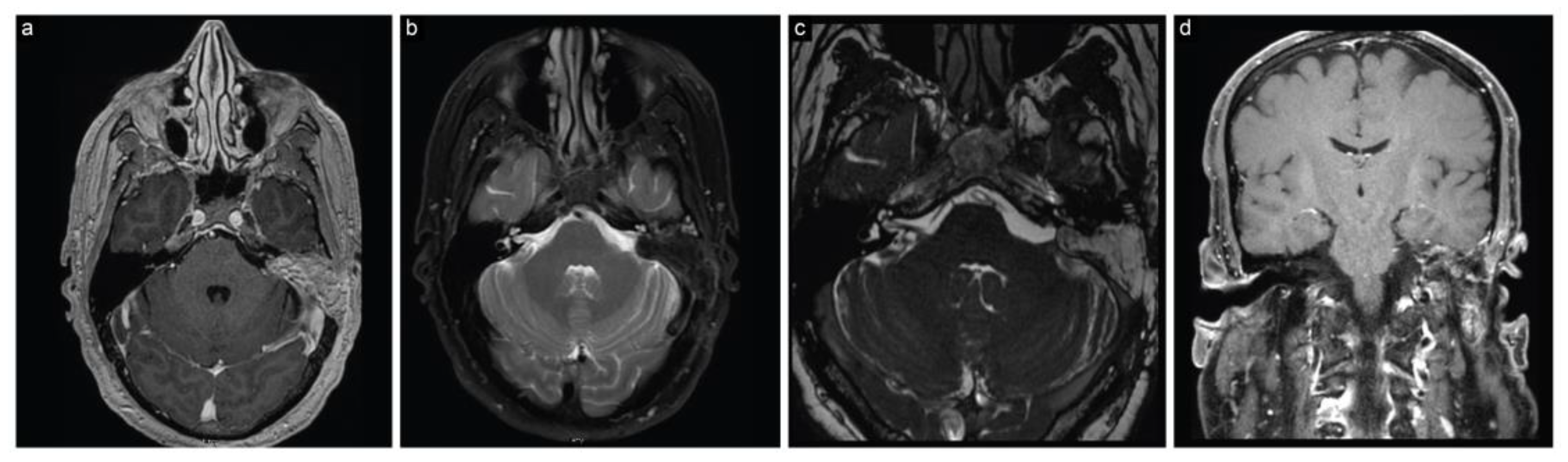 Brainsci 13 01548 g006 Brainsci 13 01548 g006