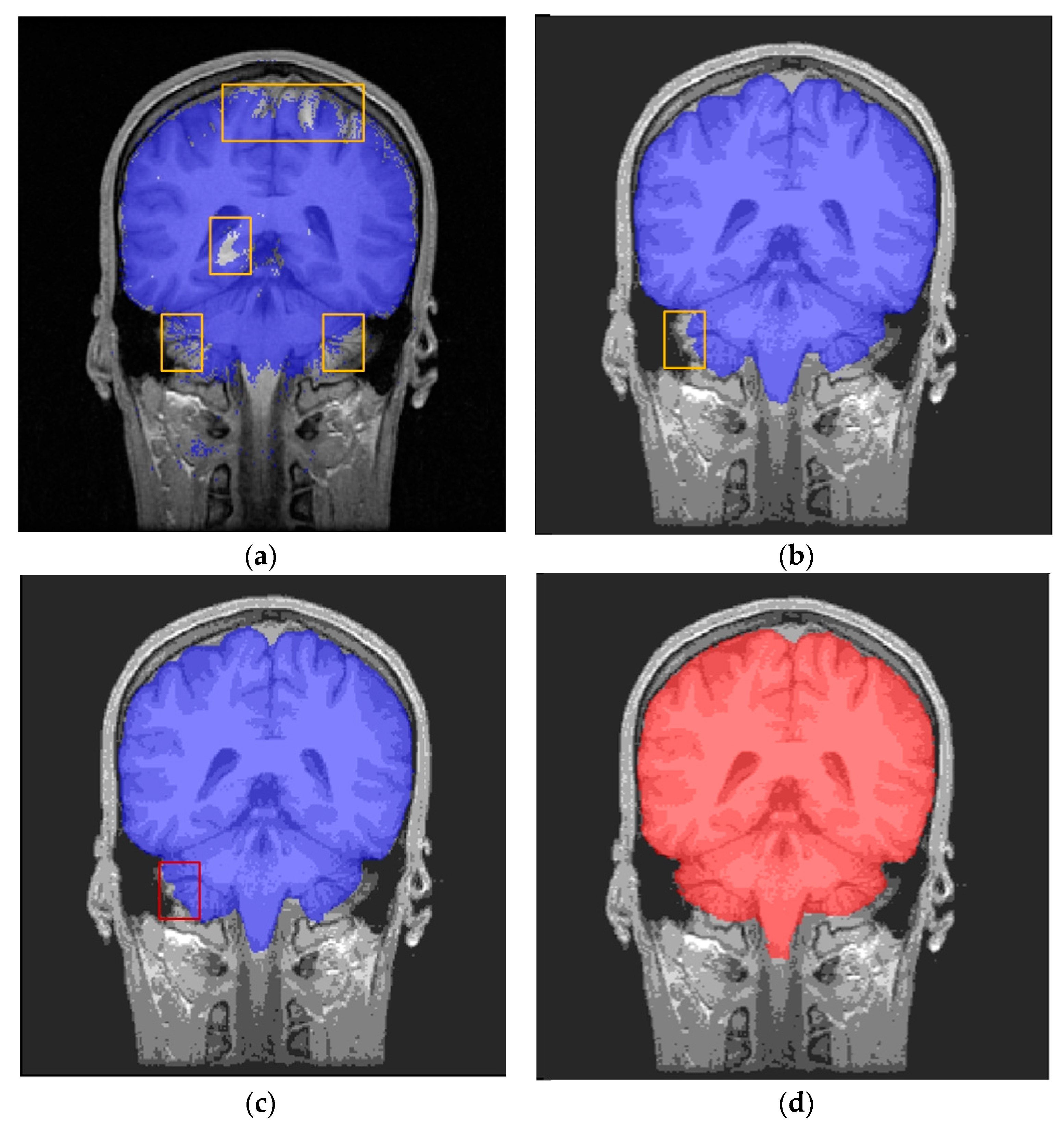 Brainsci 13 01549 g009