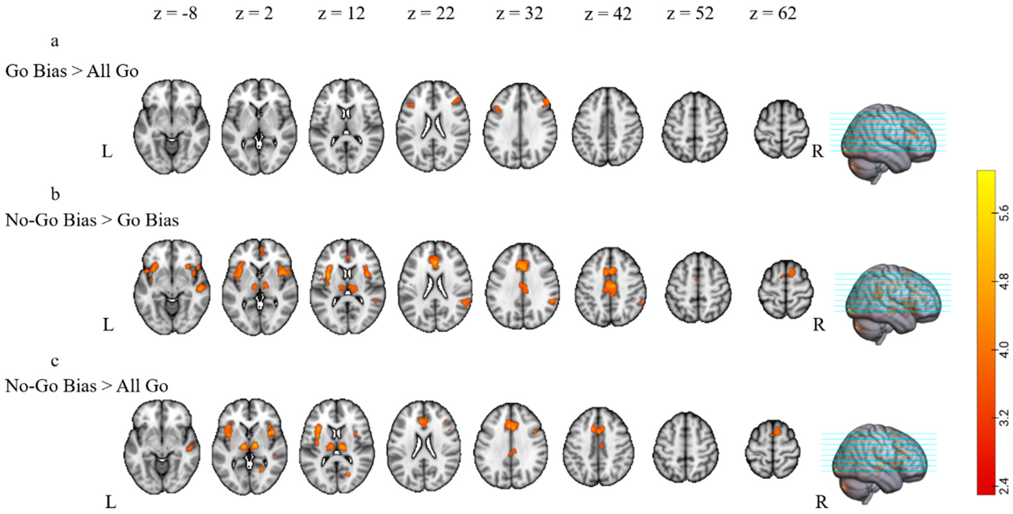 Brainsci 13 01587 g003 Brainsci 13 01587 g003