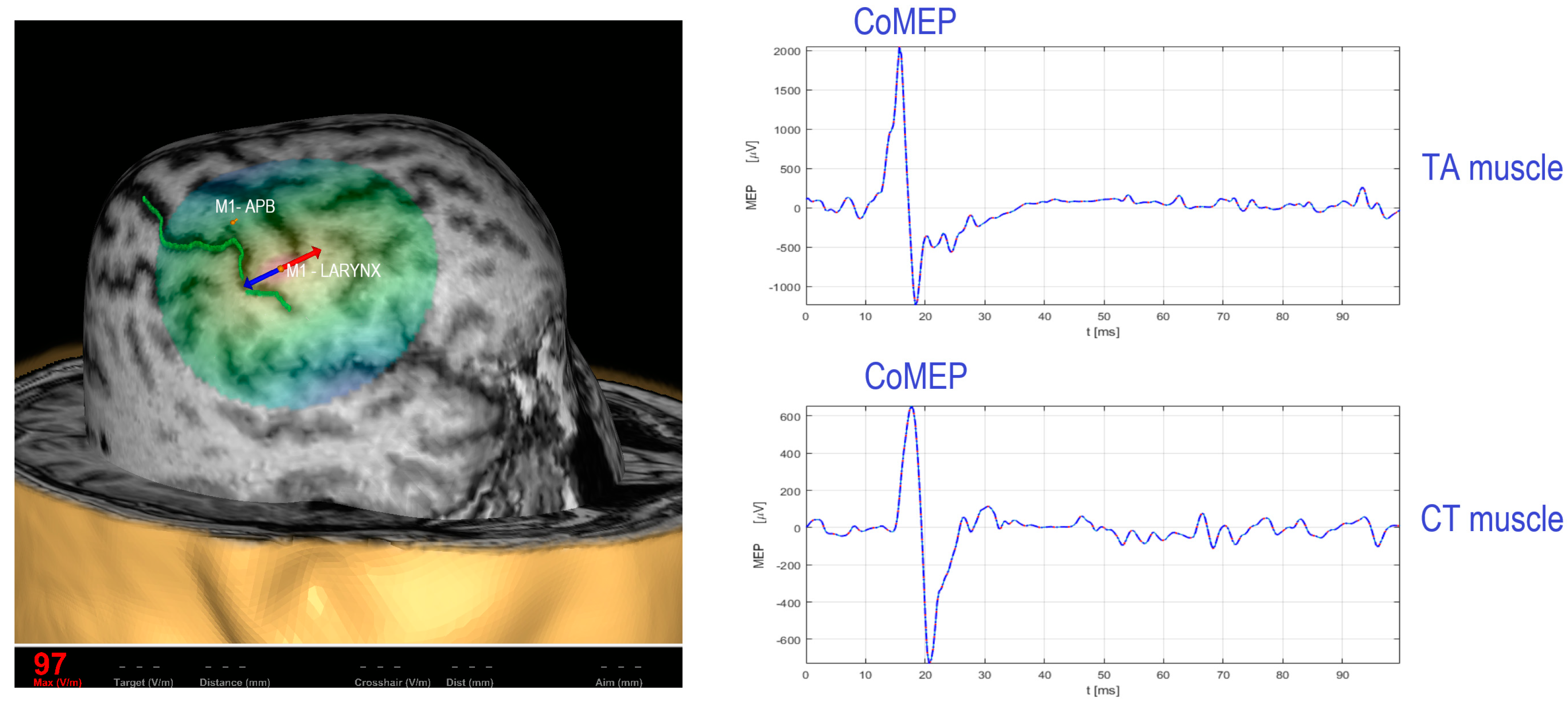Brainsci 13 01591 g001 Brainsci 13 01591 g001