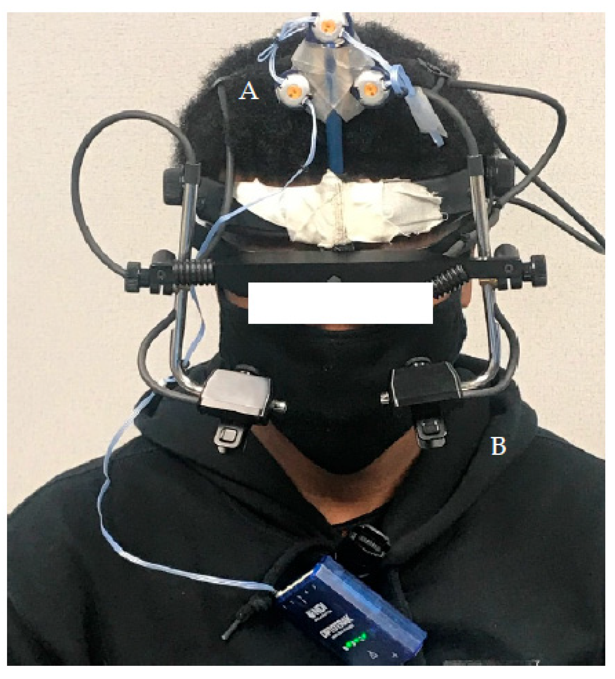 Brainsci 13 01603 g001 Brainsci 13 01603 g001