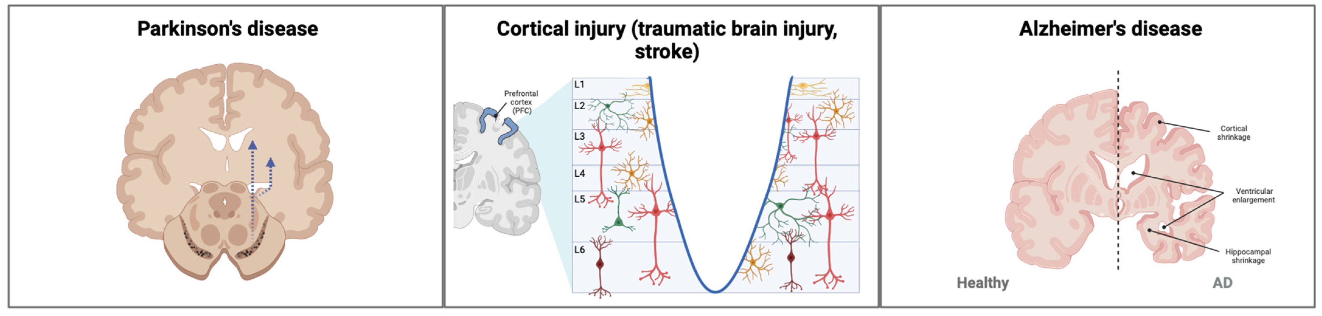 Brainsci 13 01654 g001