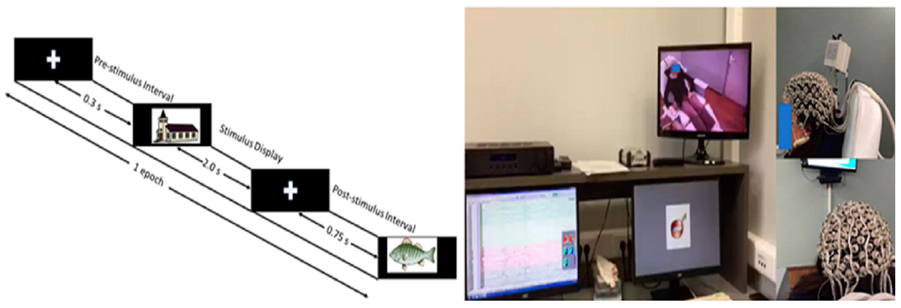 Brainsci 13 01656 g001 Brainsci 13 01656 g001