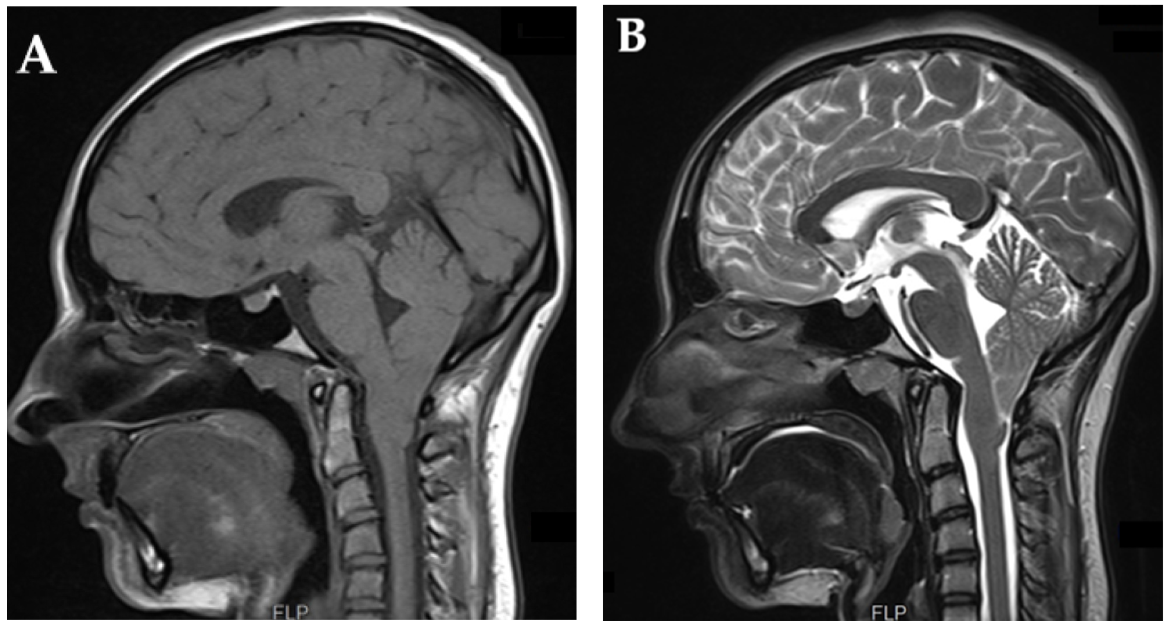 Brainsci 13 01658 g002 Brainsci 13 01658 g002