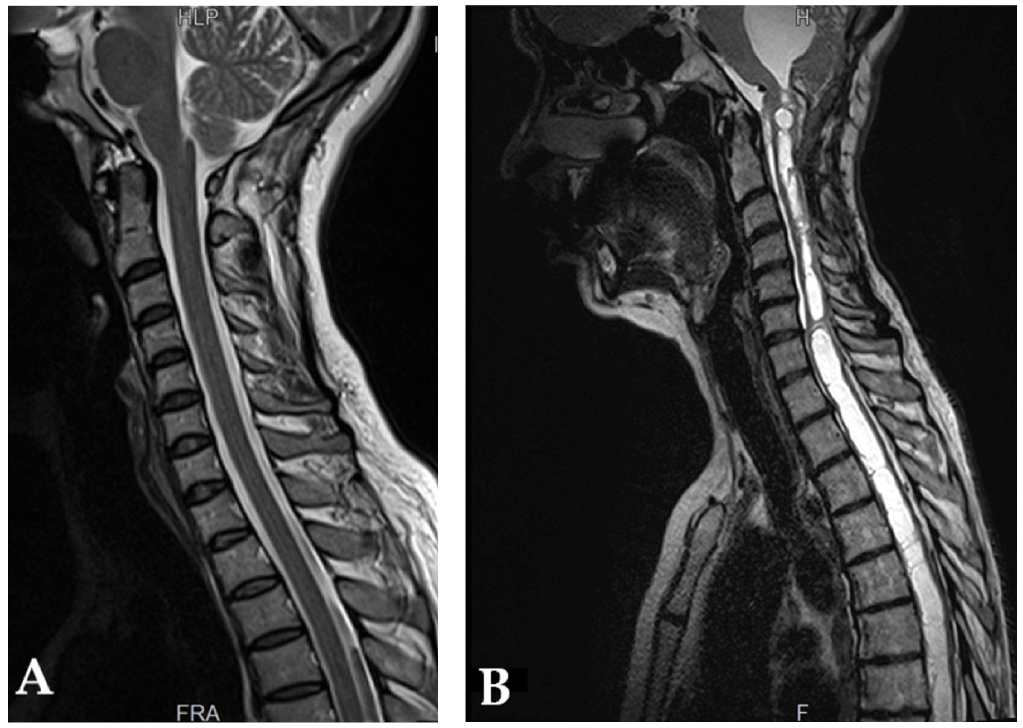 Brainsci 13 01658 g003 Brainsci 13 01658 g003