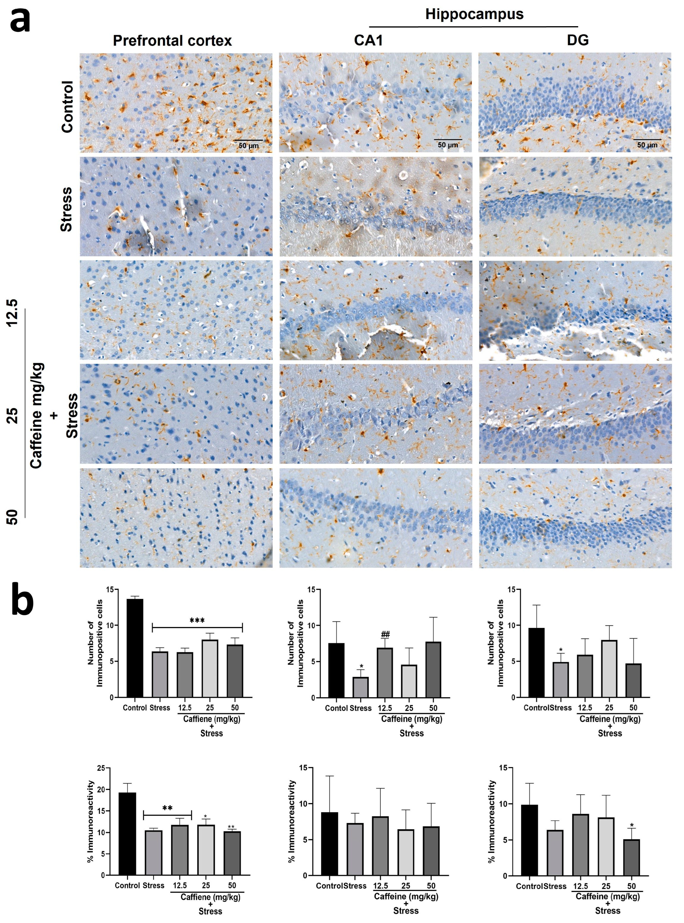 Brainsci 13 01663 g013
