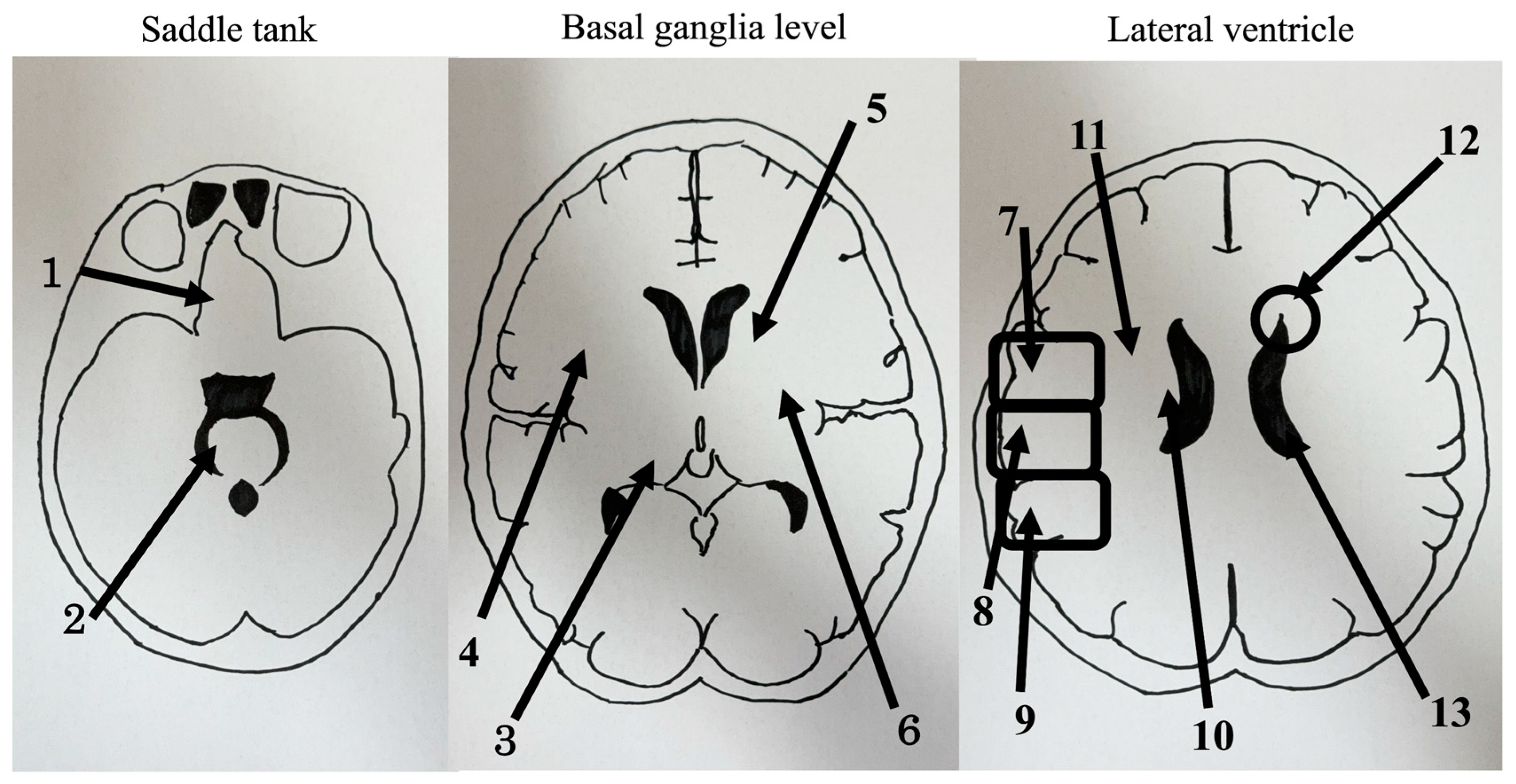 Brainsci 13 01690 g001 Brainsci 13 01690 g001