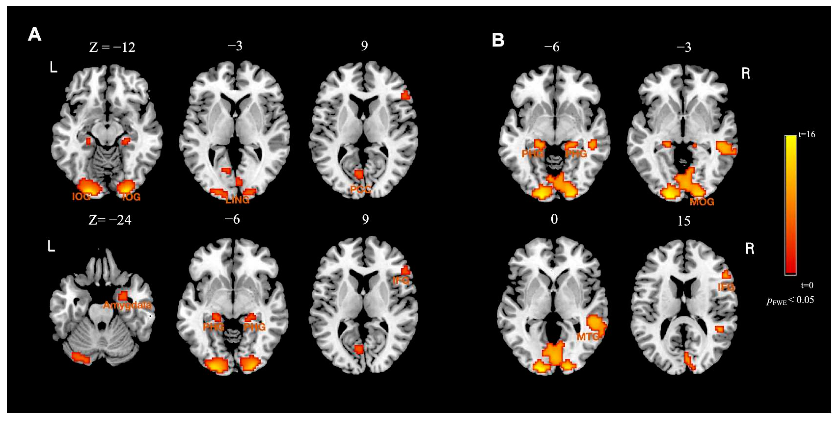Brainsci 13 01699 g005