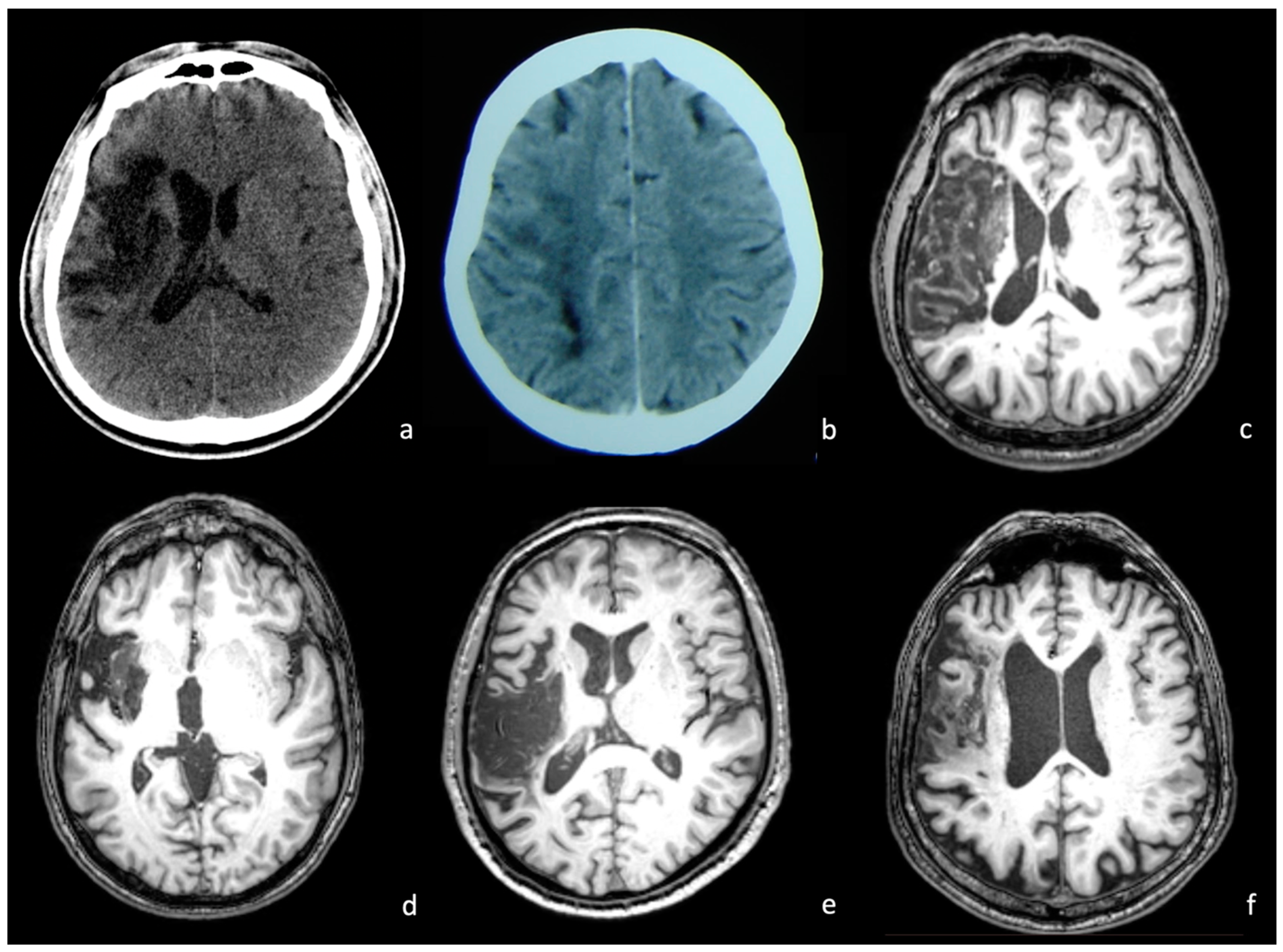 Brainsci 14 00007 g002