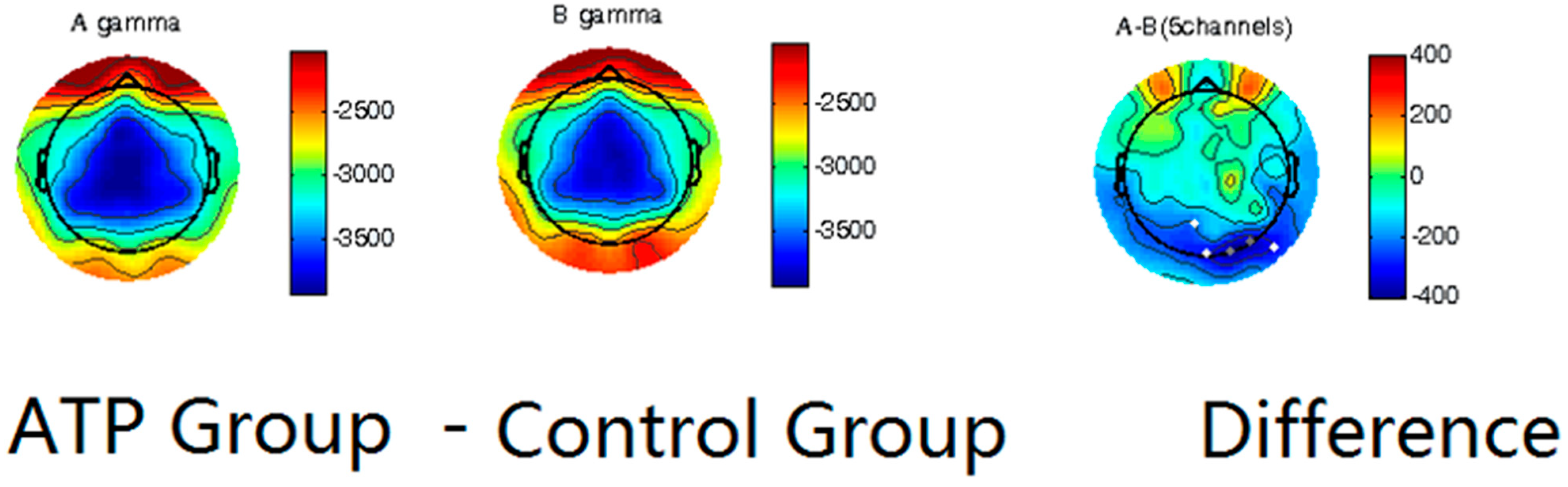 Brainsci 14 00091 g002
