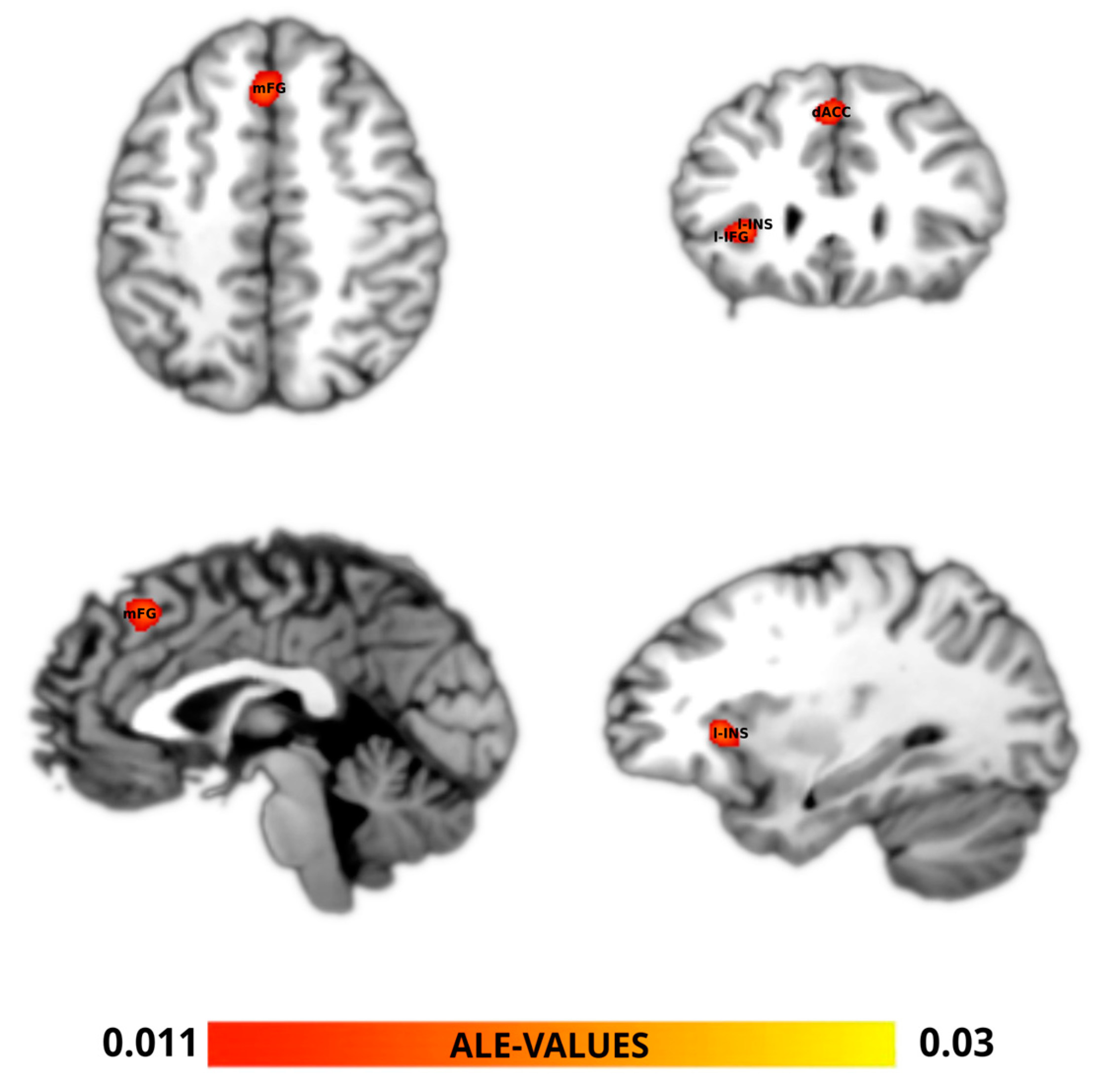 Brainsci 14 00101 g002 Brainsci 14 00101 g002