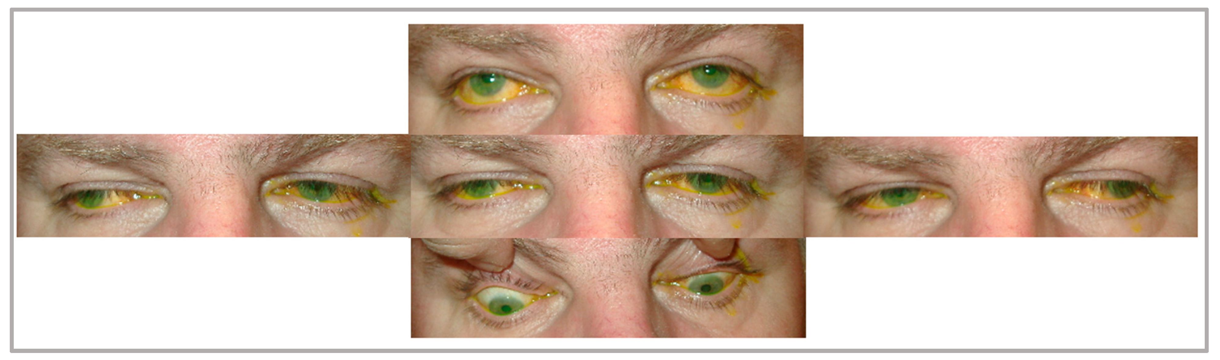 Brainsci 14 00135 g003