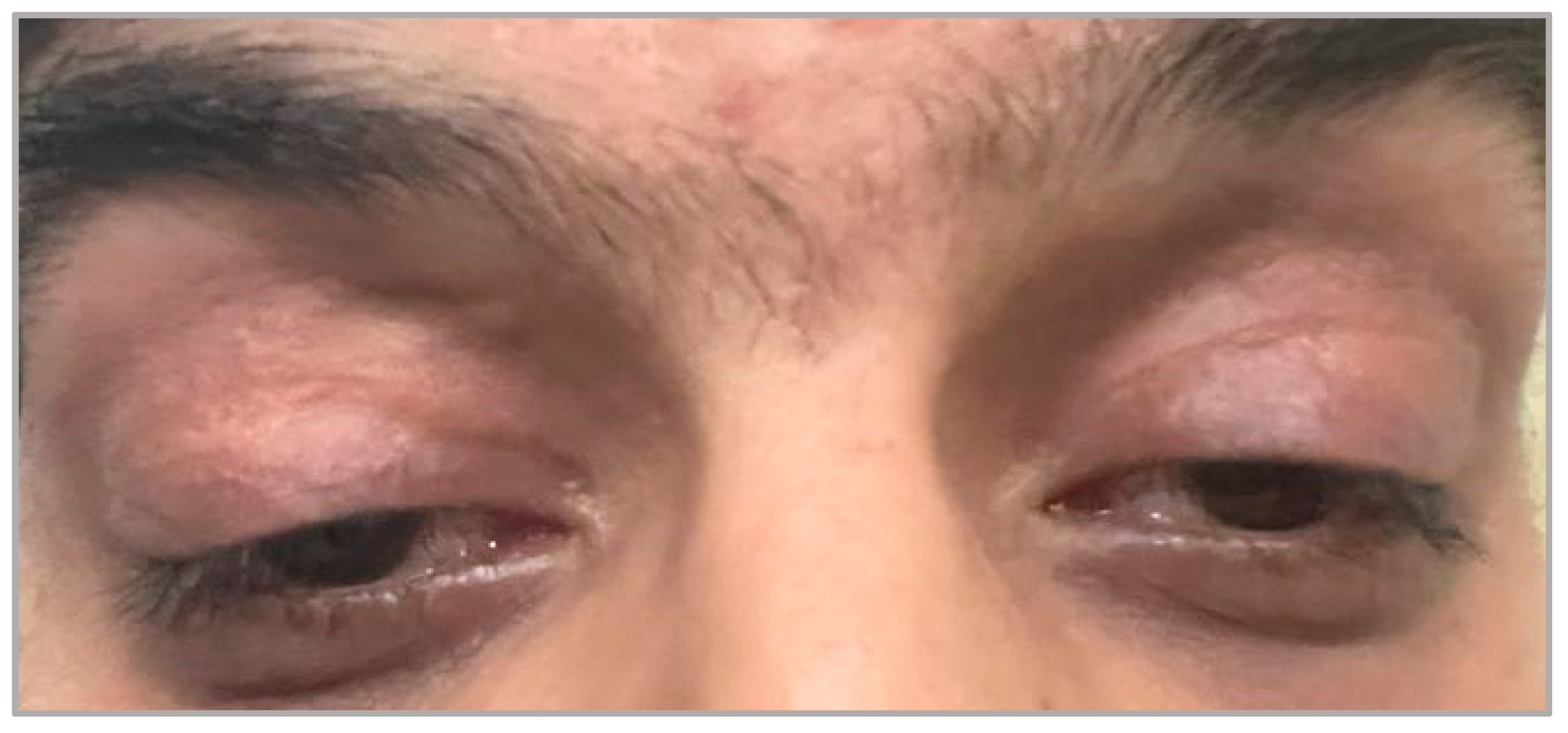 Brainsci 14 00135 g004