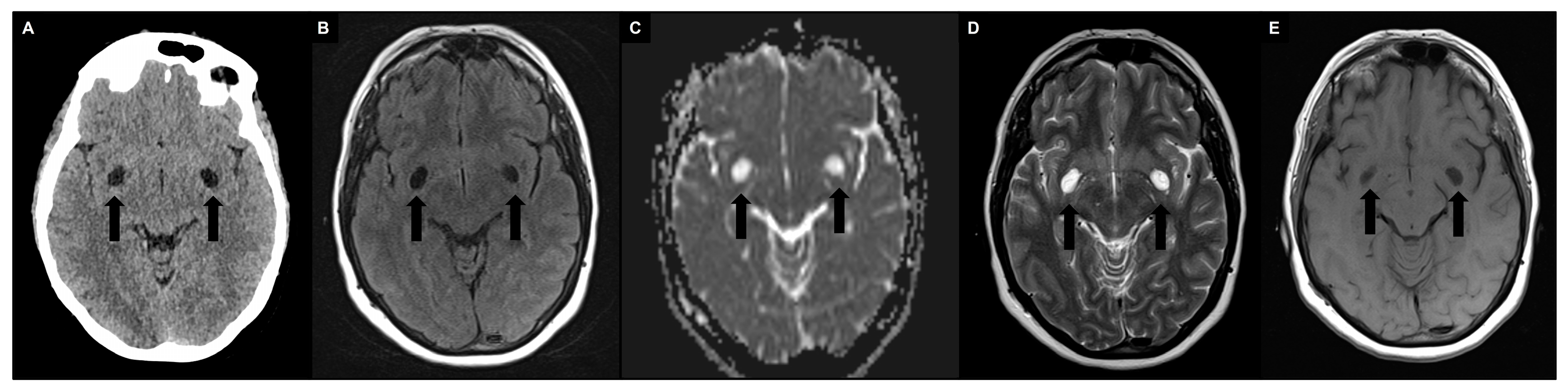 Brainsci 14 00138 g002