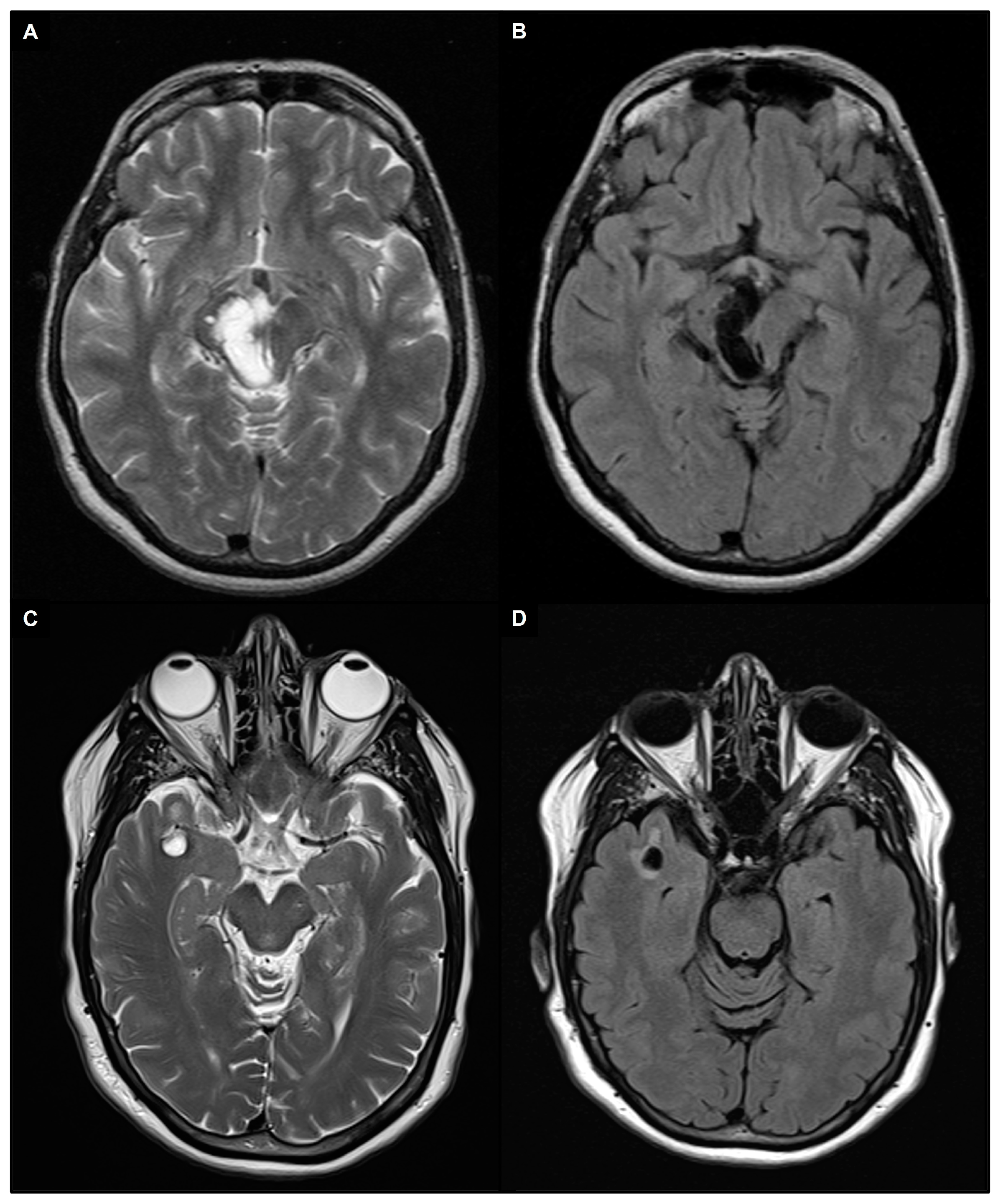 Brainsci 14 00138 g003