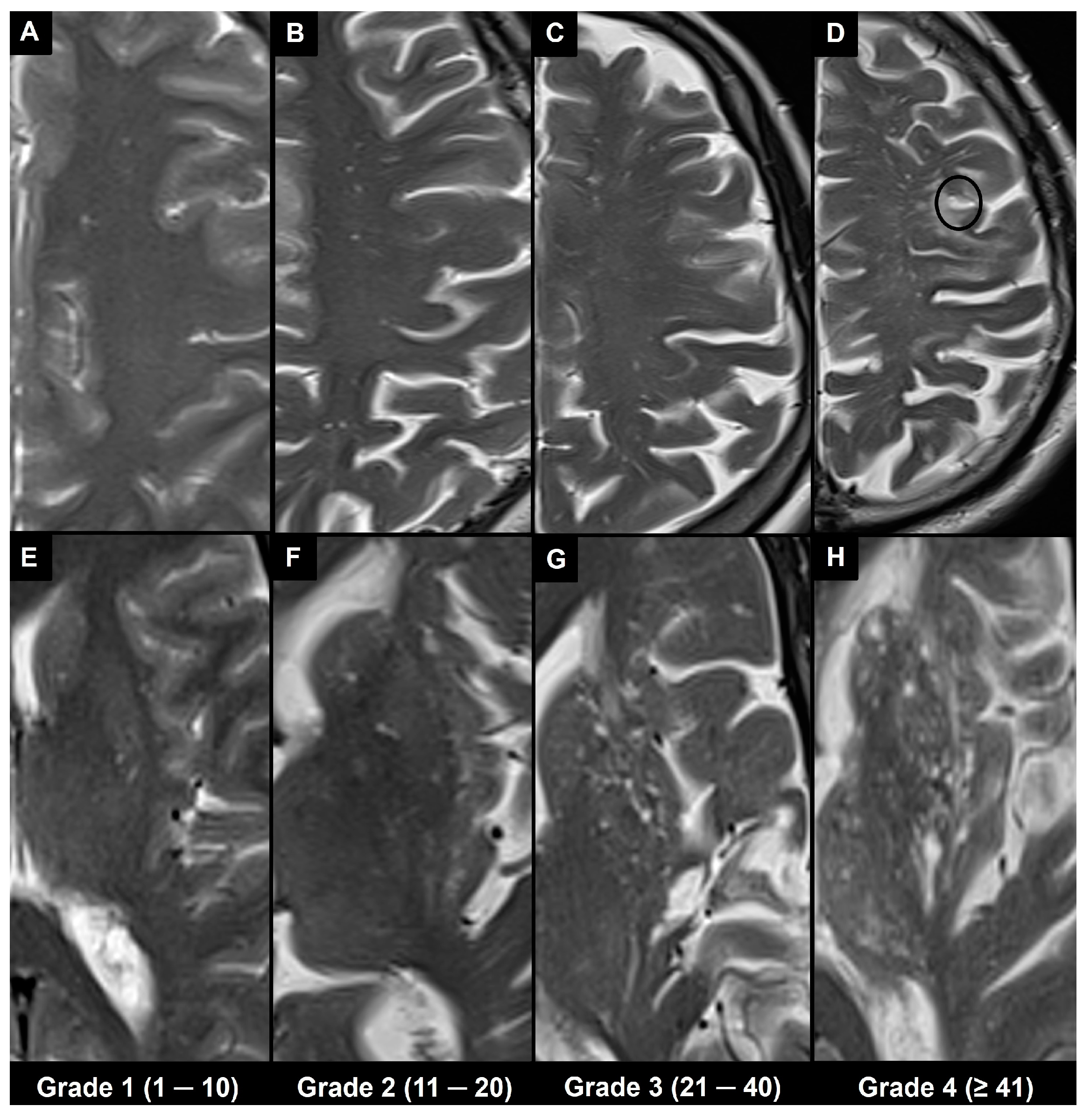 Brainsci 14 00138 g004