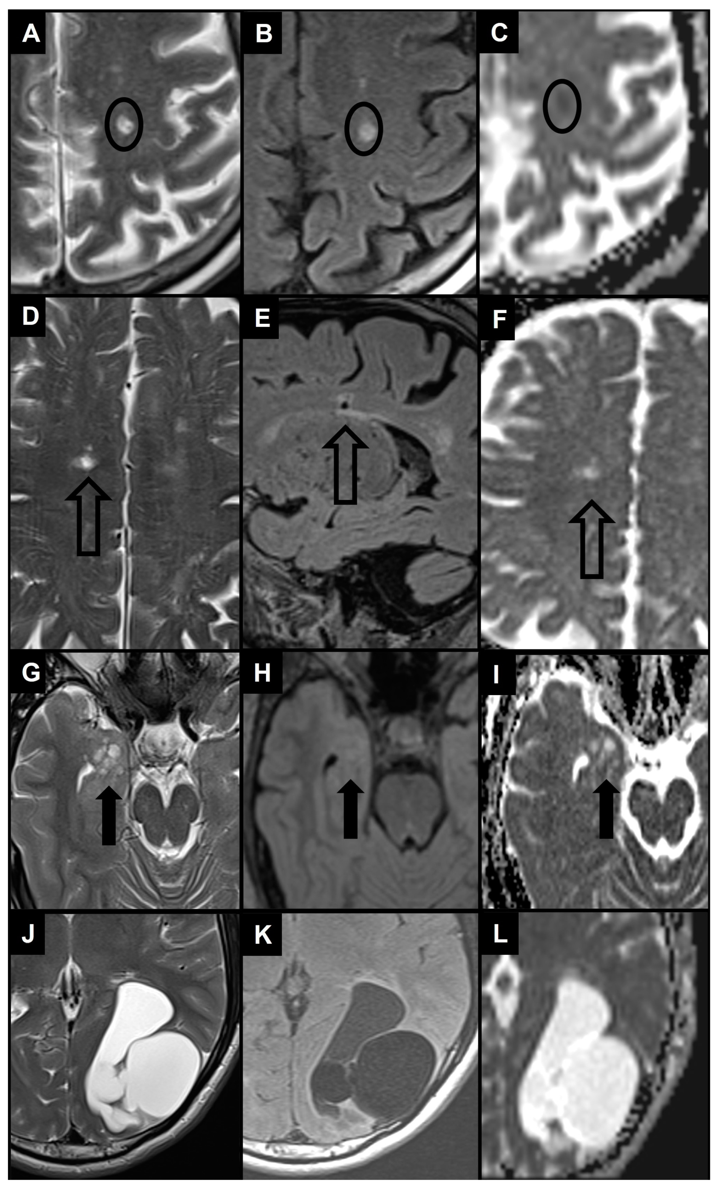 Brainsci 14 00138 g005