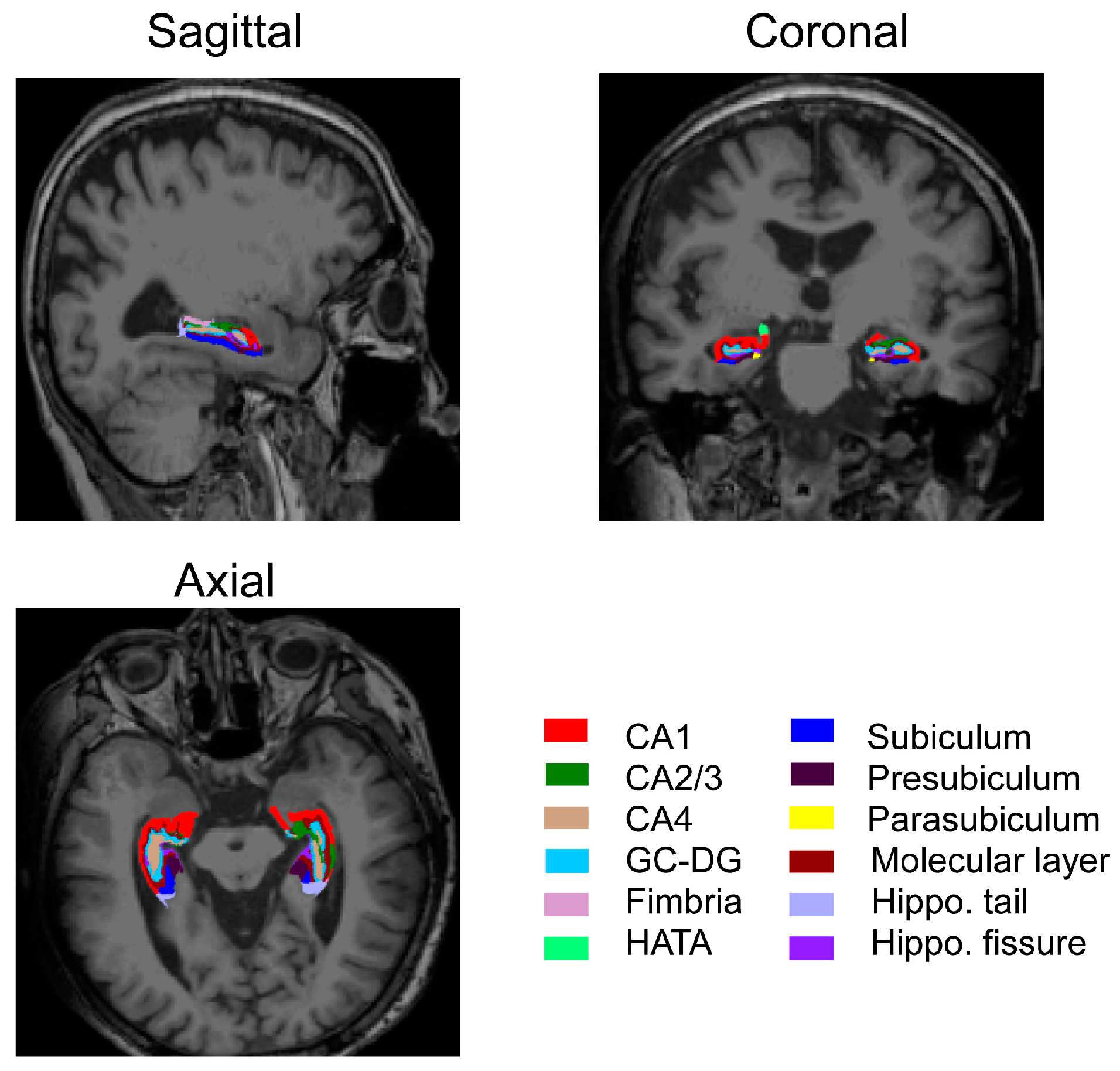 Brainsci 14 00170 g002