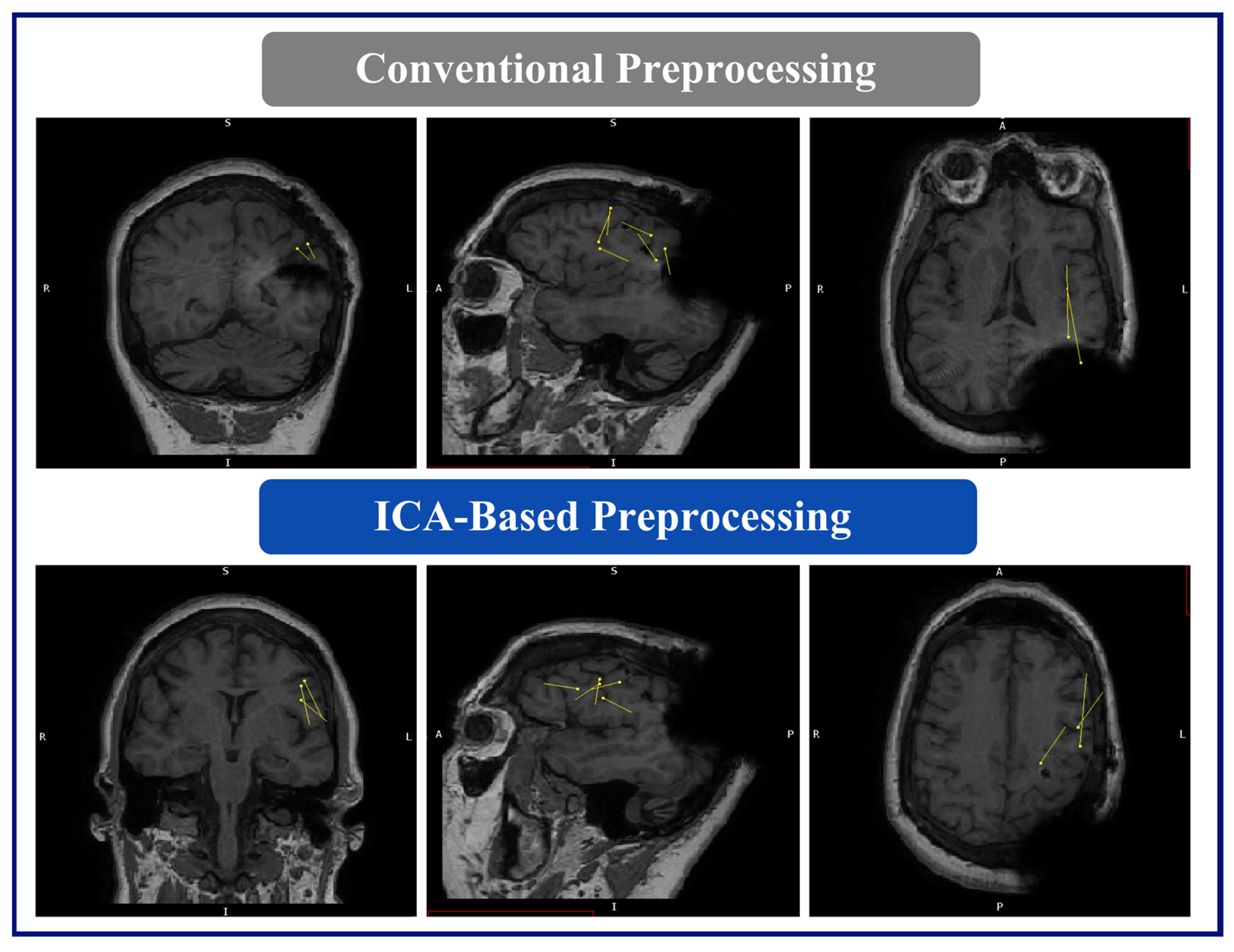 Brainsci 14 00173 g005