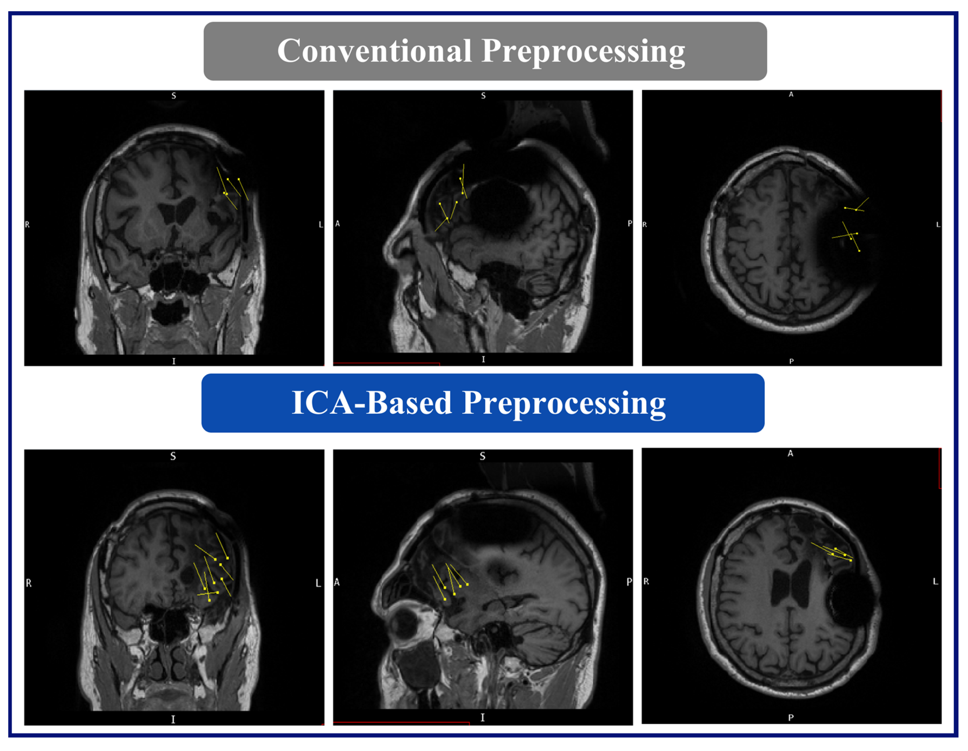 Brainsci 14 00173 g006