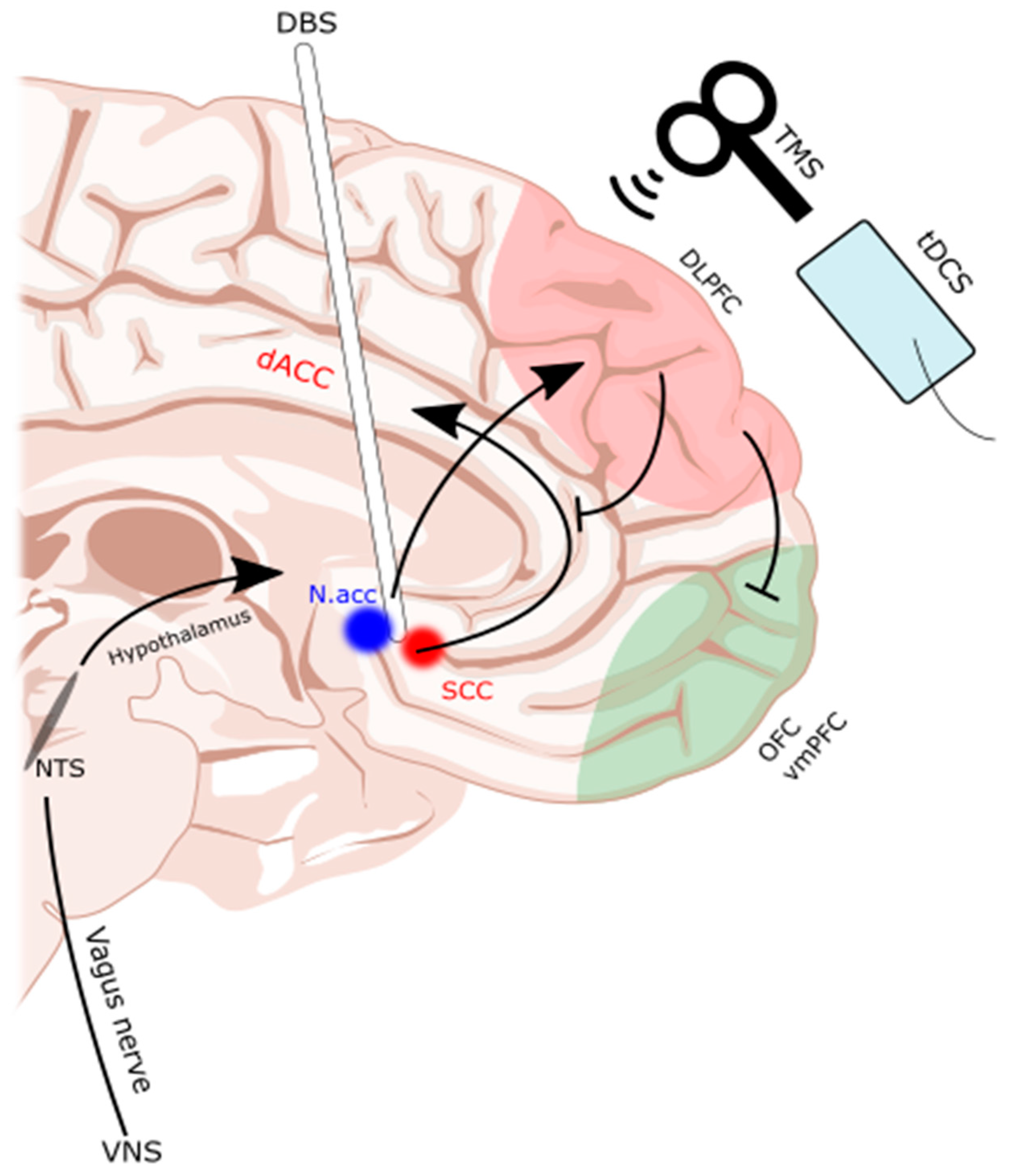 Brainsci 14 00200 g001 Brainsci 14 00200 g001