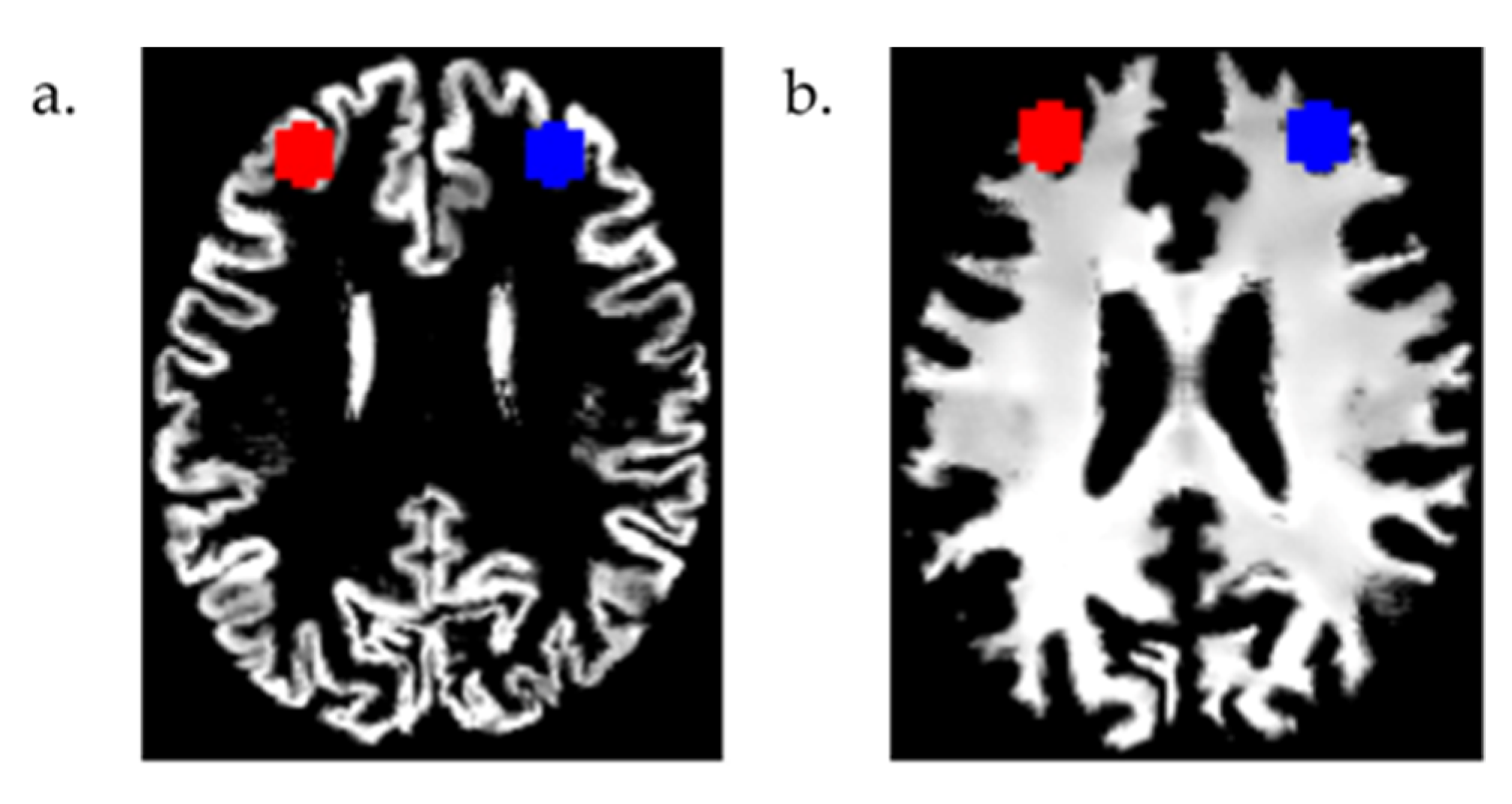 Brainsci 14 00226 g001