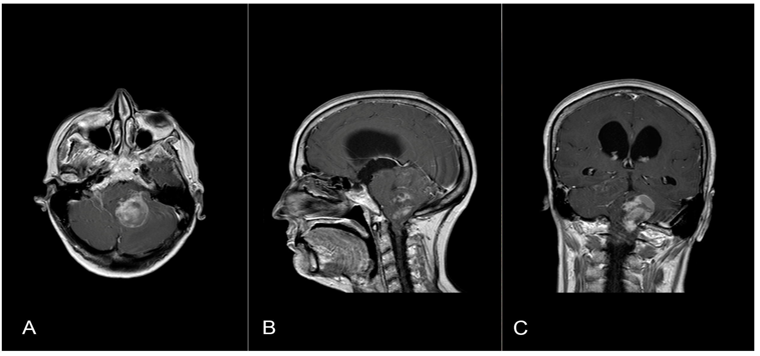 Brainsci 14 00286 g002 Brainsci 14 00286 g002