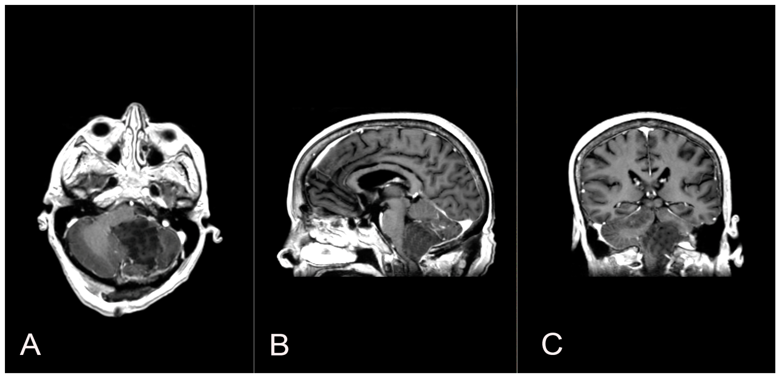 Brainsci 14 00286 g003 Brainsci 14 00286 g003