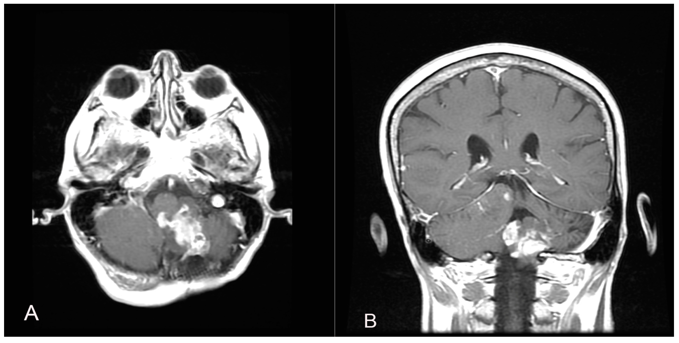 Brainsci 14 00286 g004 Brainsci 14 00286 g004