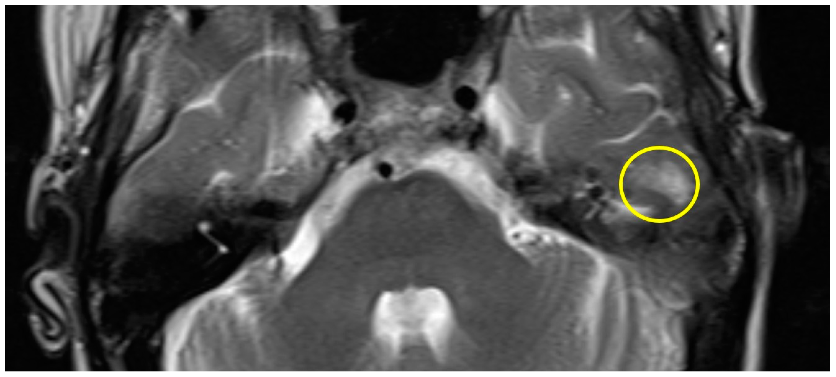 Brainsci 14 00295 g001