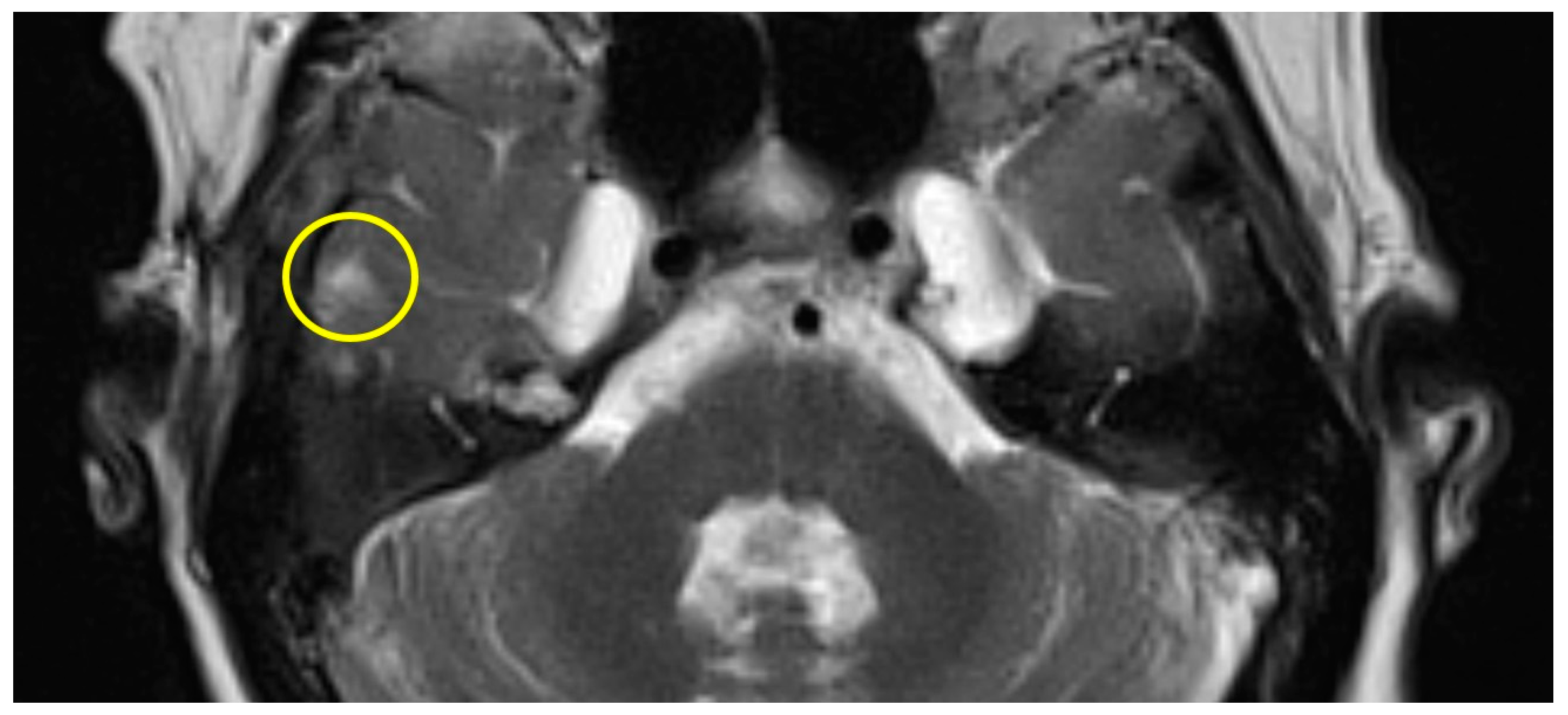 Brainsci 14 00295 g002