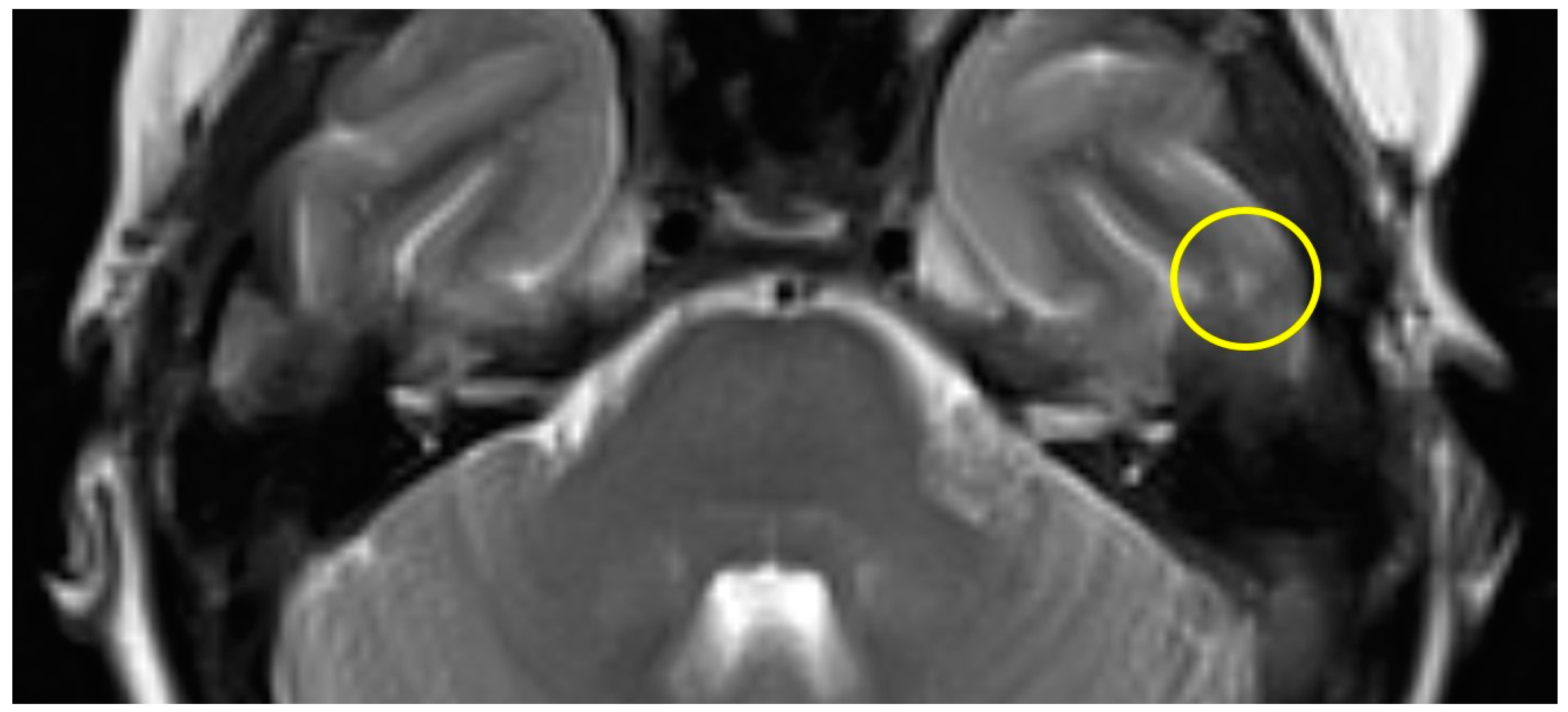 Brainsci 14 00295 g003