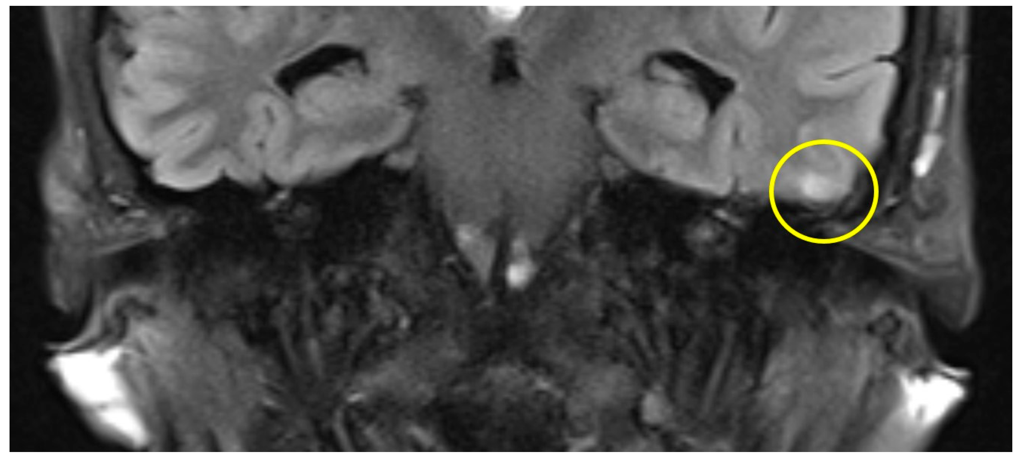 Brainsci 14 00295 g004