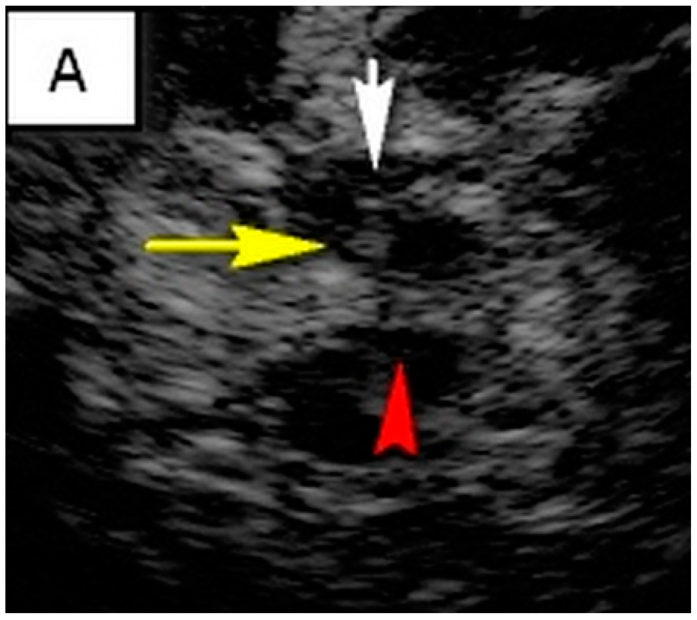 Brainsci 14 00340 g001a
