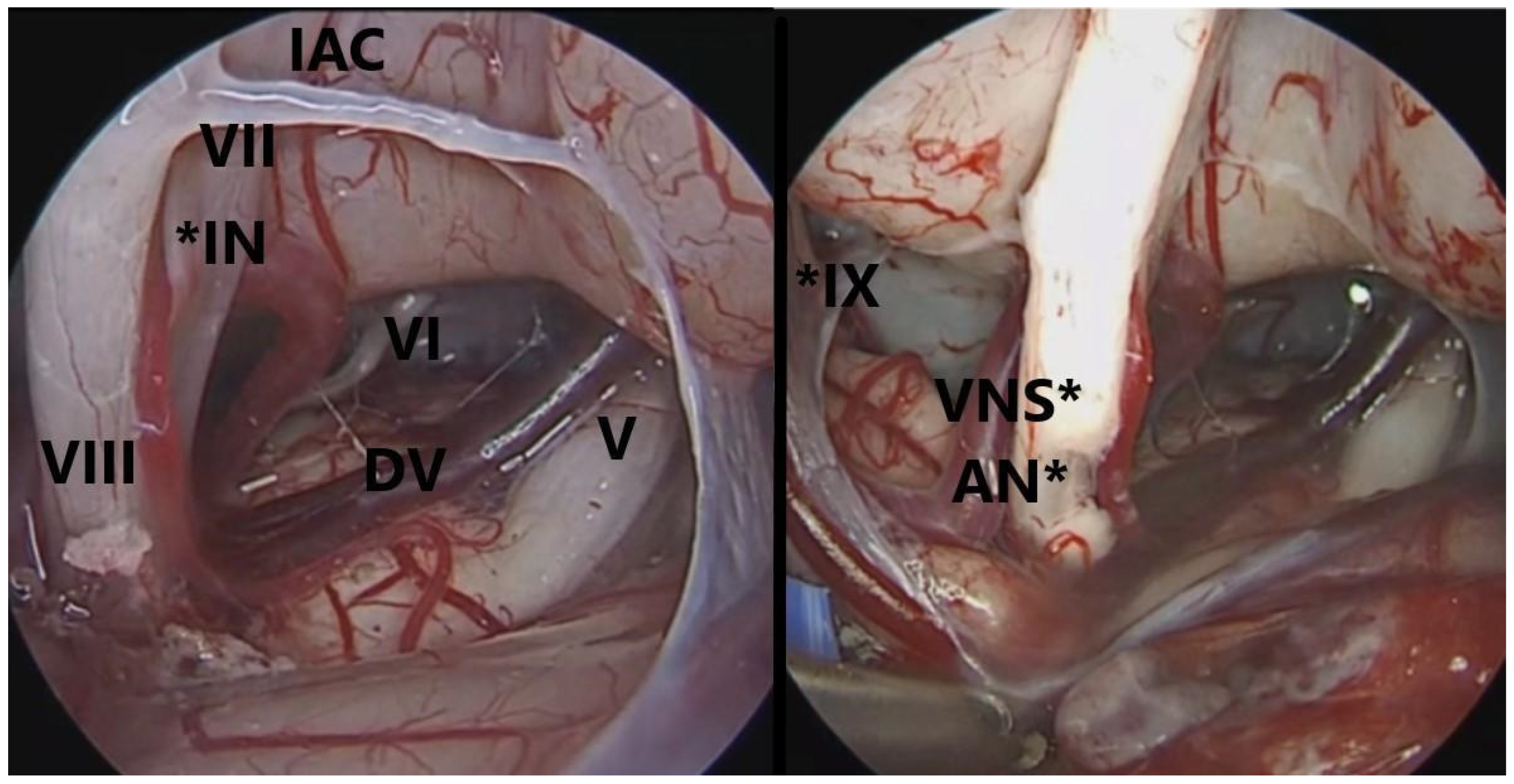 Brainsci 14 00369 g002 Brainsci 14 00369 g002