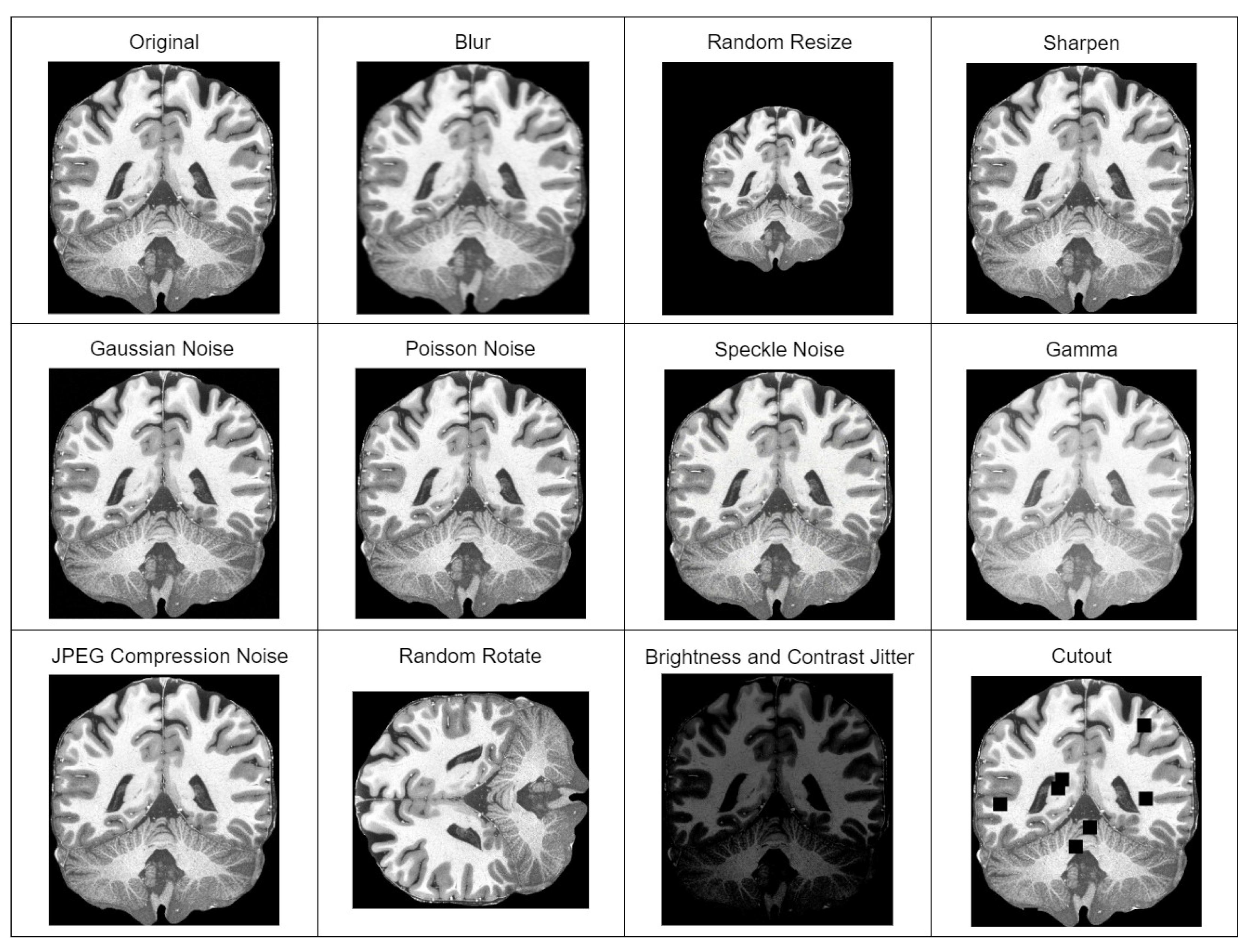 Brainsci 14 00381 g001