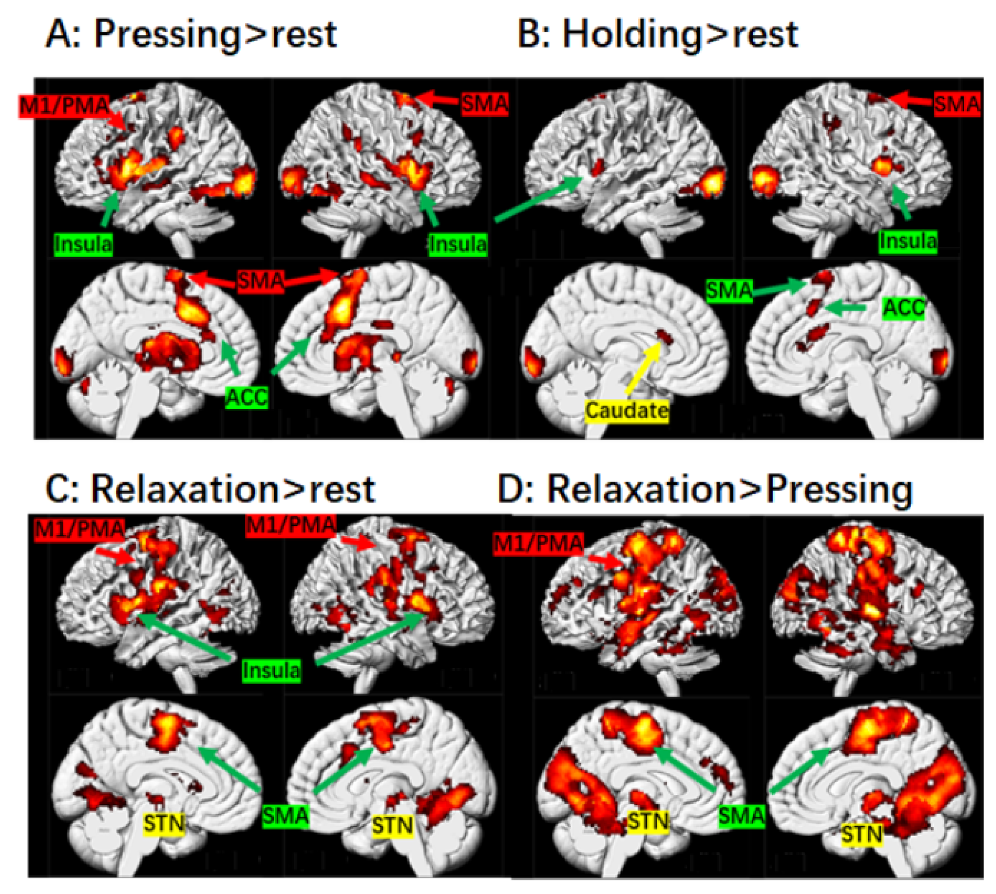 Brainsci 14 00404 g001