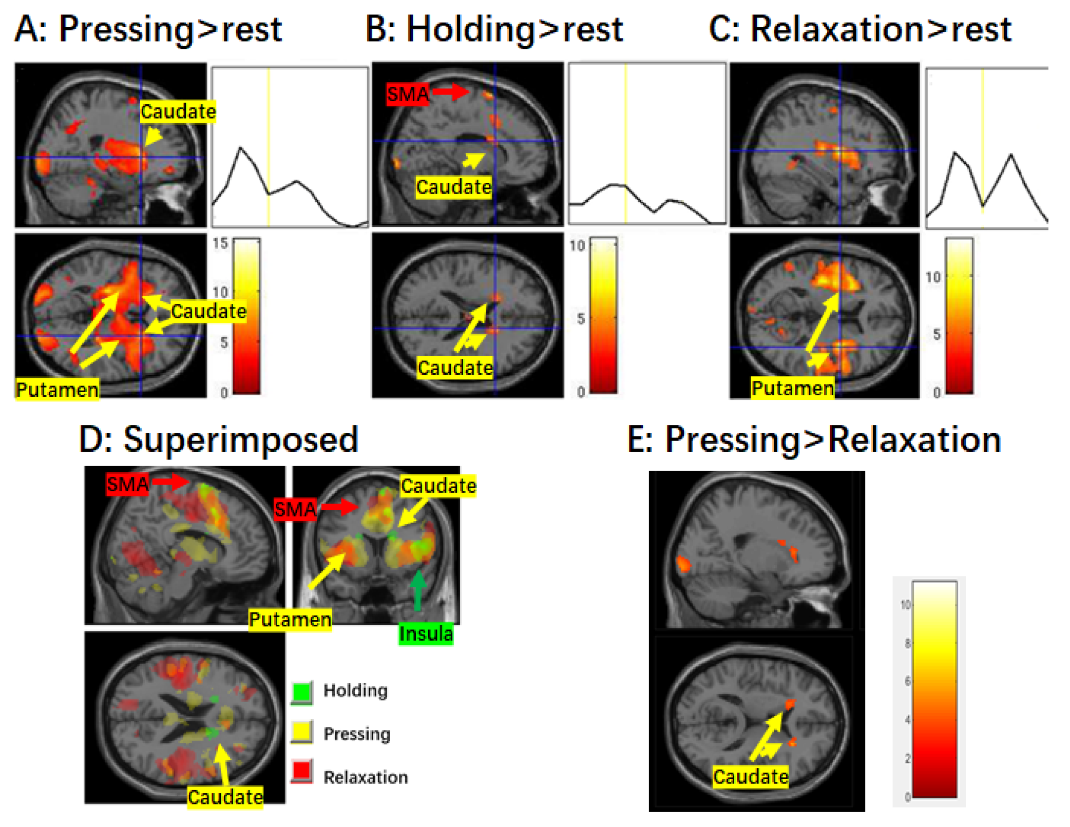 Brainsci 14 00404 g002