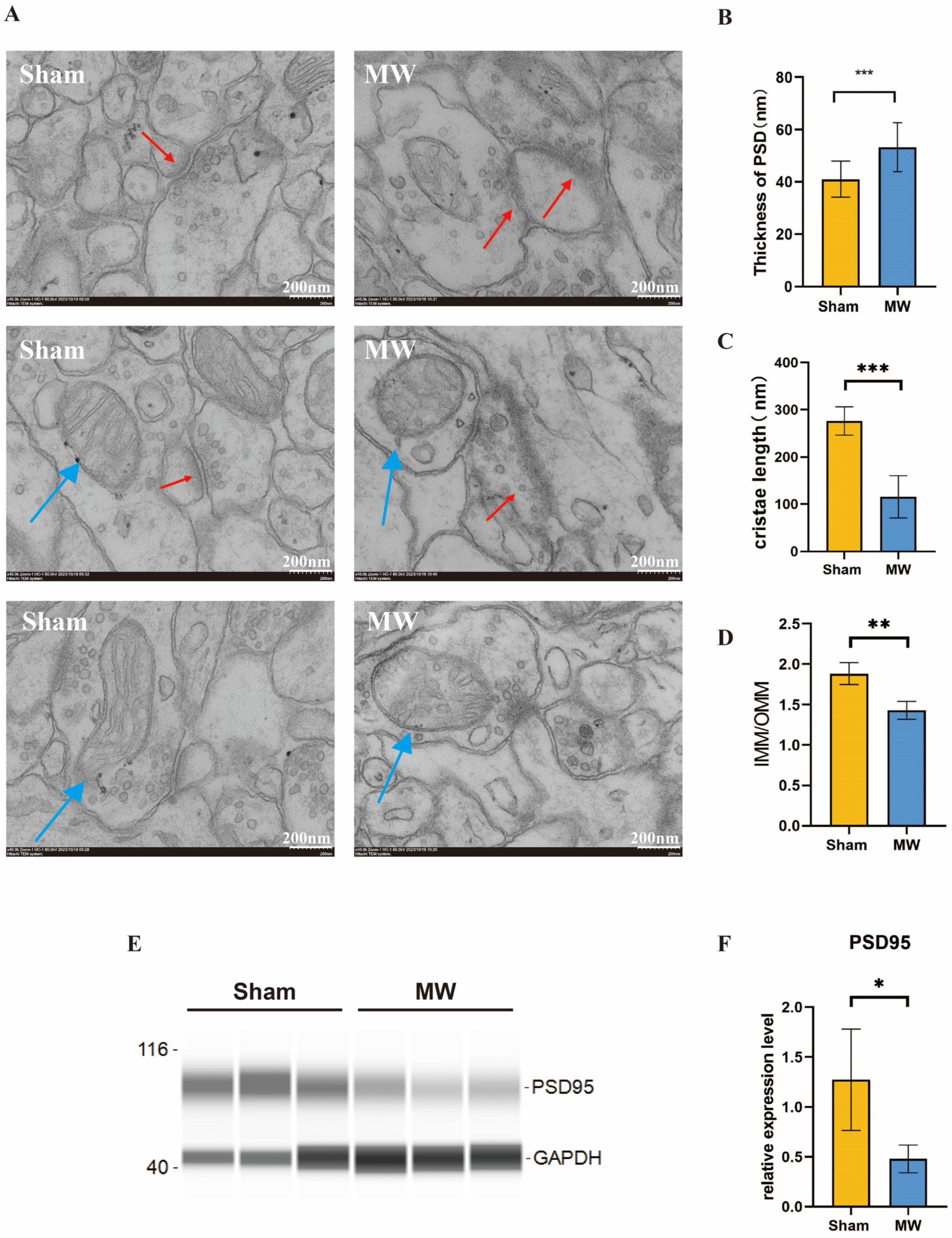 Brainsci 14 00441 g003