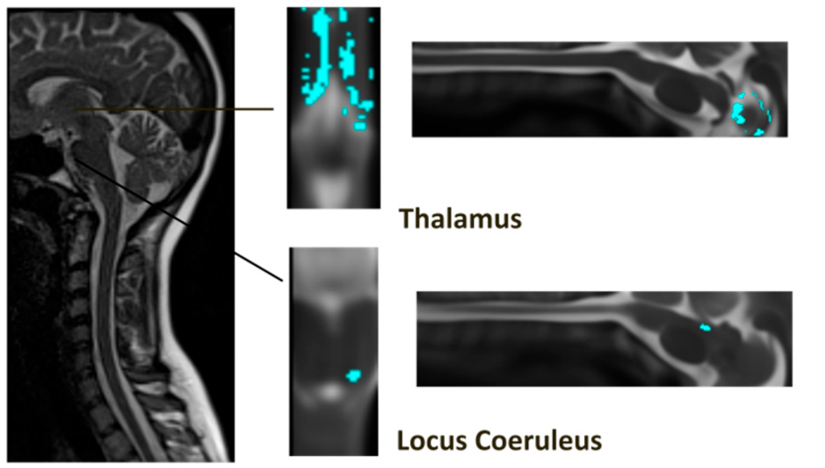 Brainsci 14 00450 g005