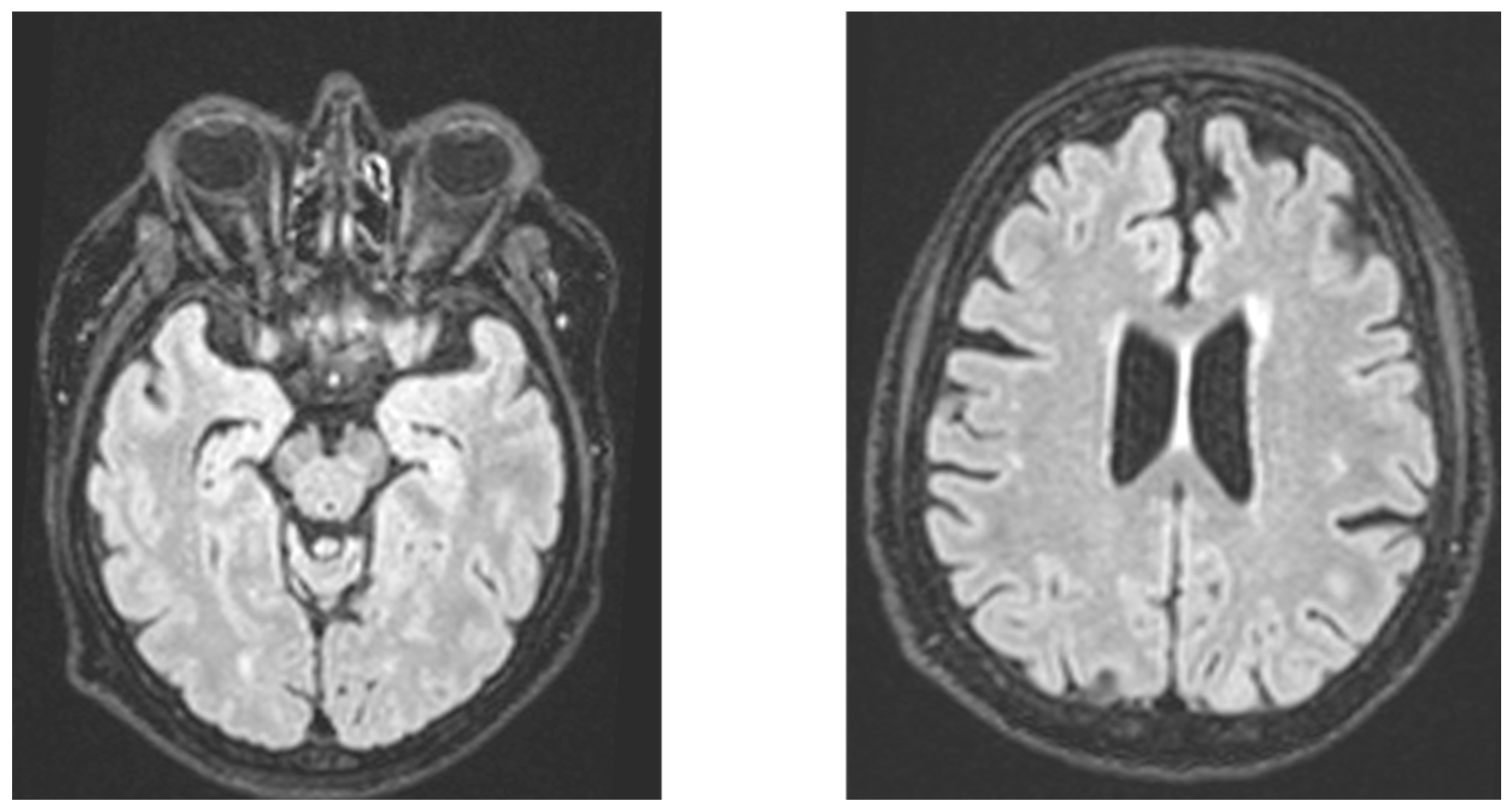 Brainsci 14 00500 g001 Brainsci 14 00500 g001