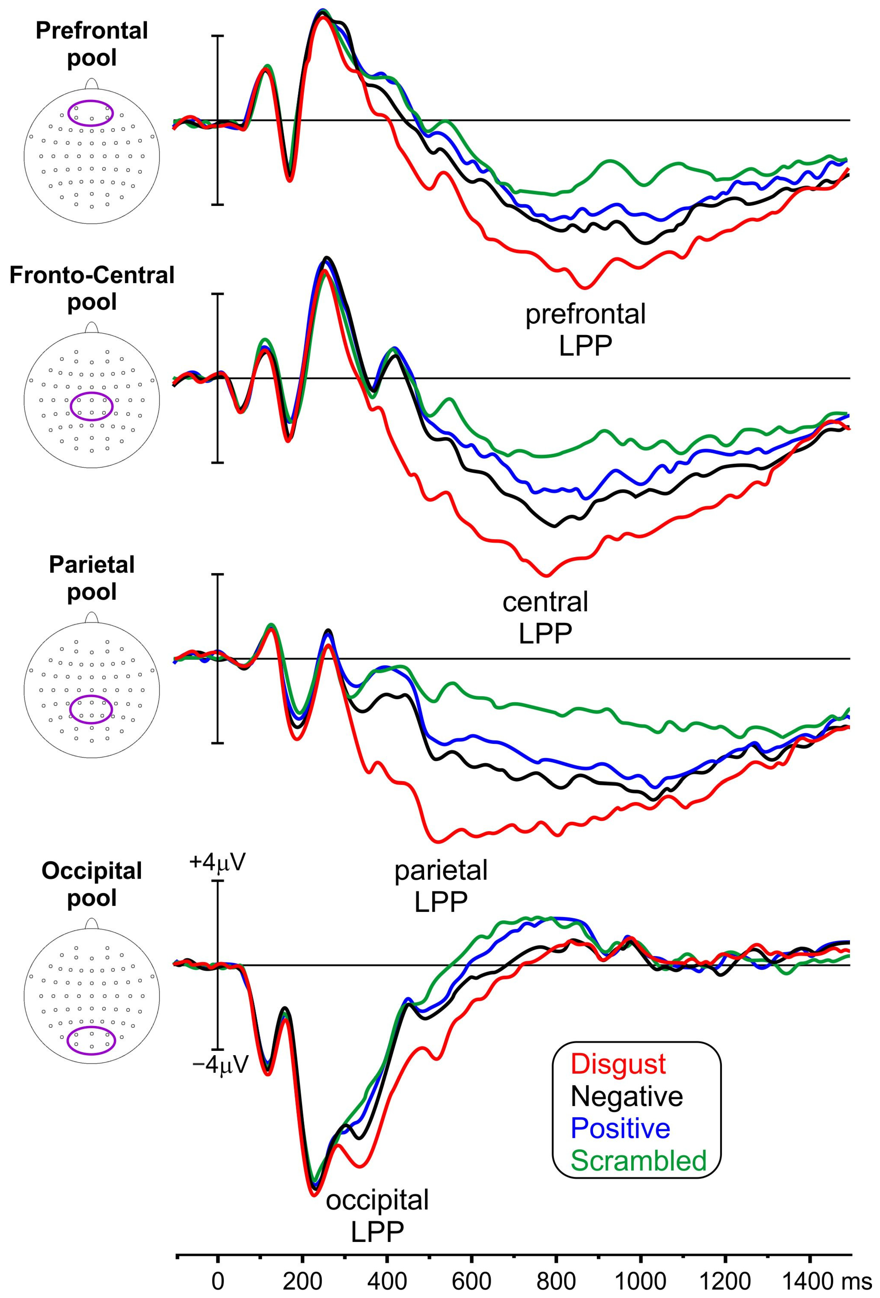 Brainsci 14 00525 g003