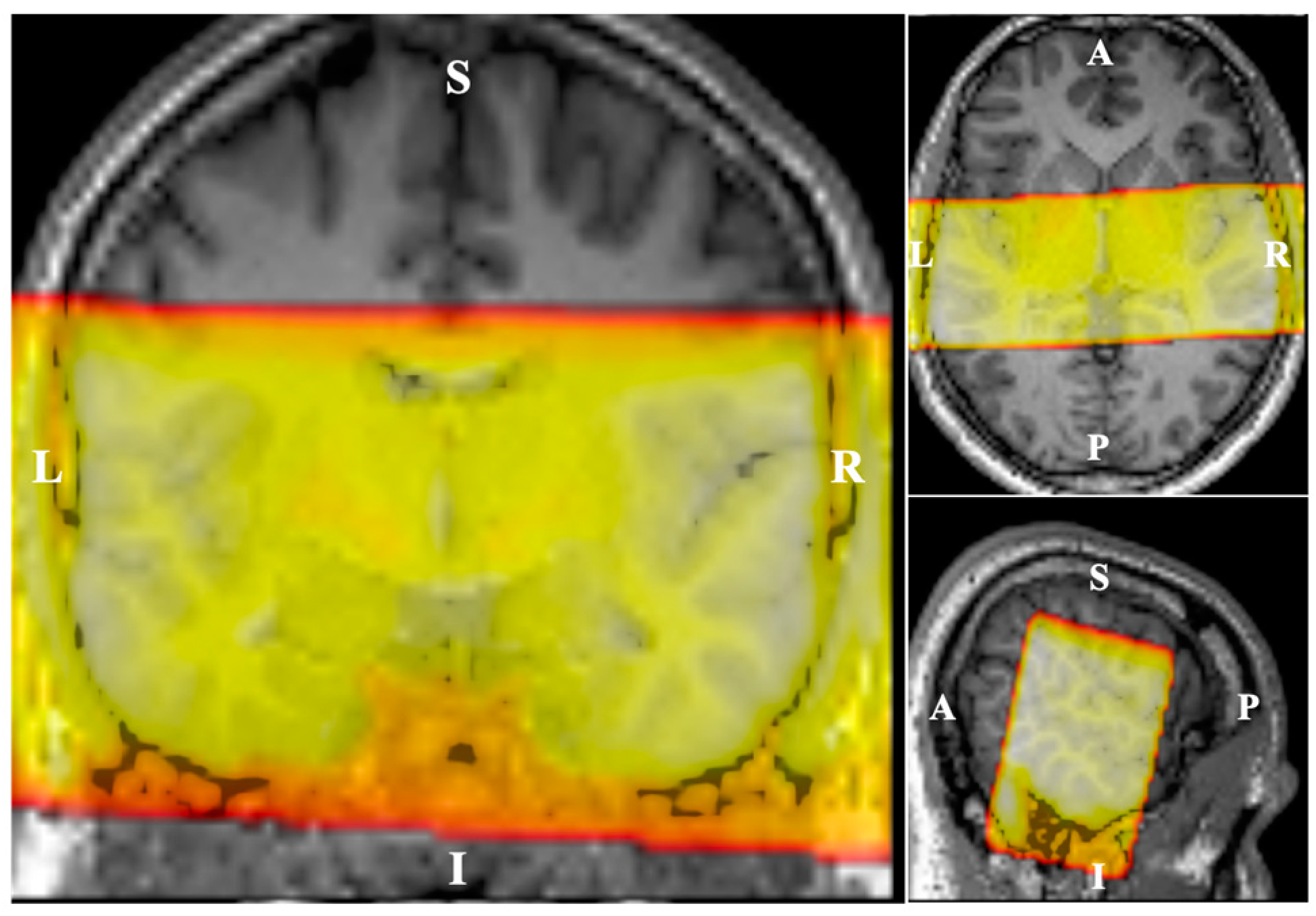 Brainsci 14 00544 g001