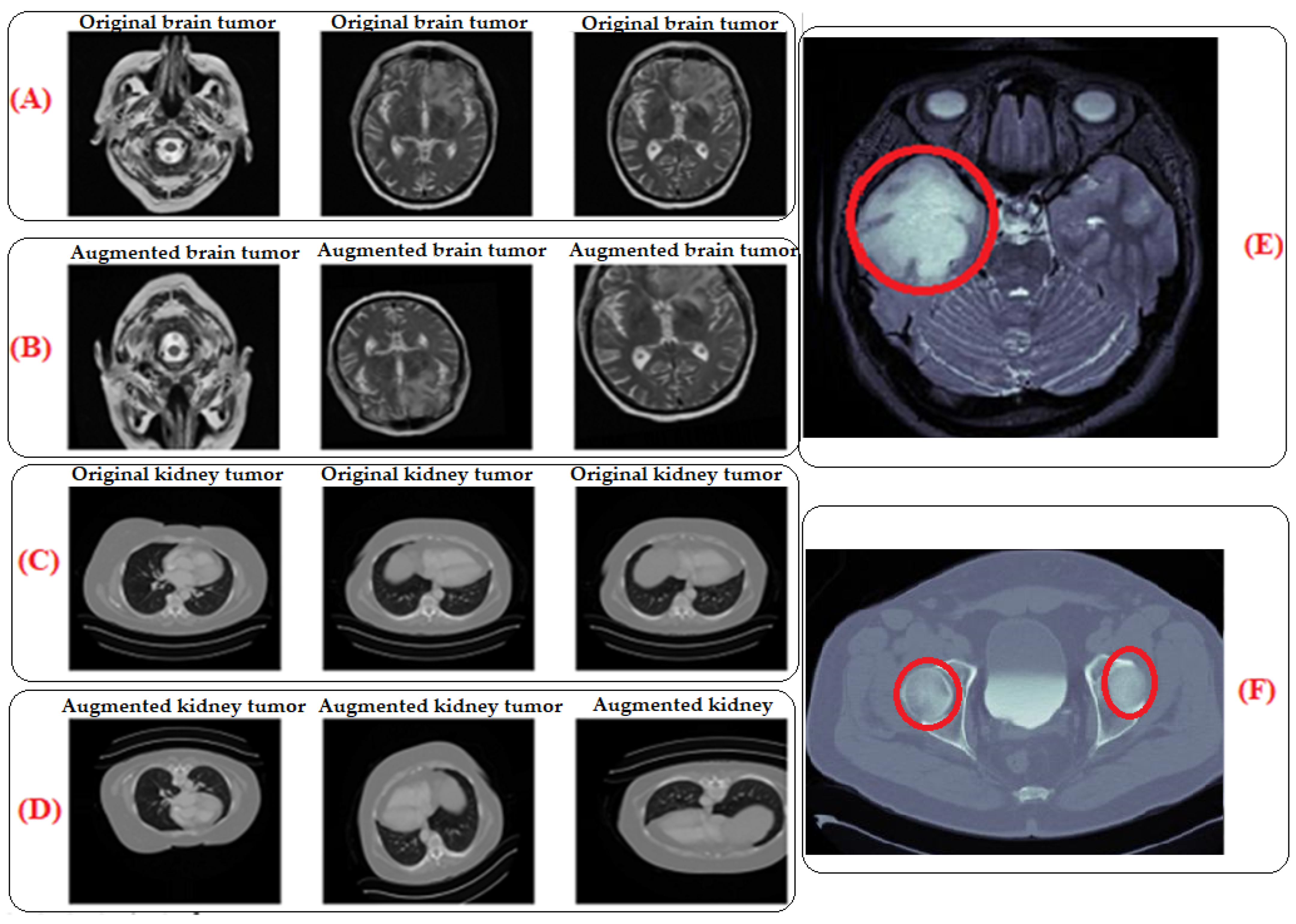 Brainsci 14 00559 g002